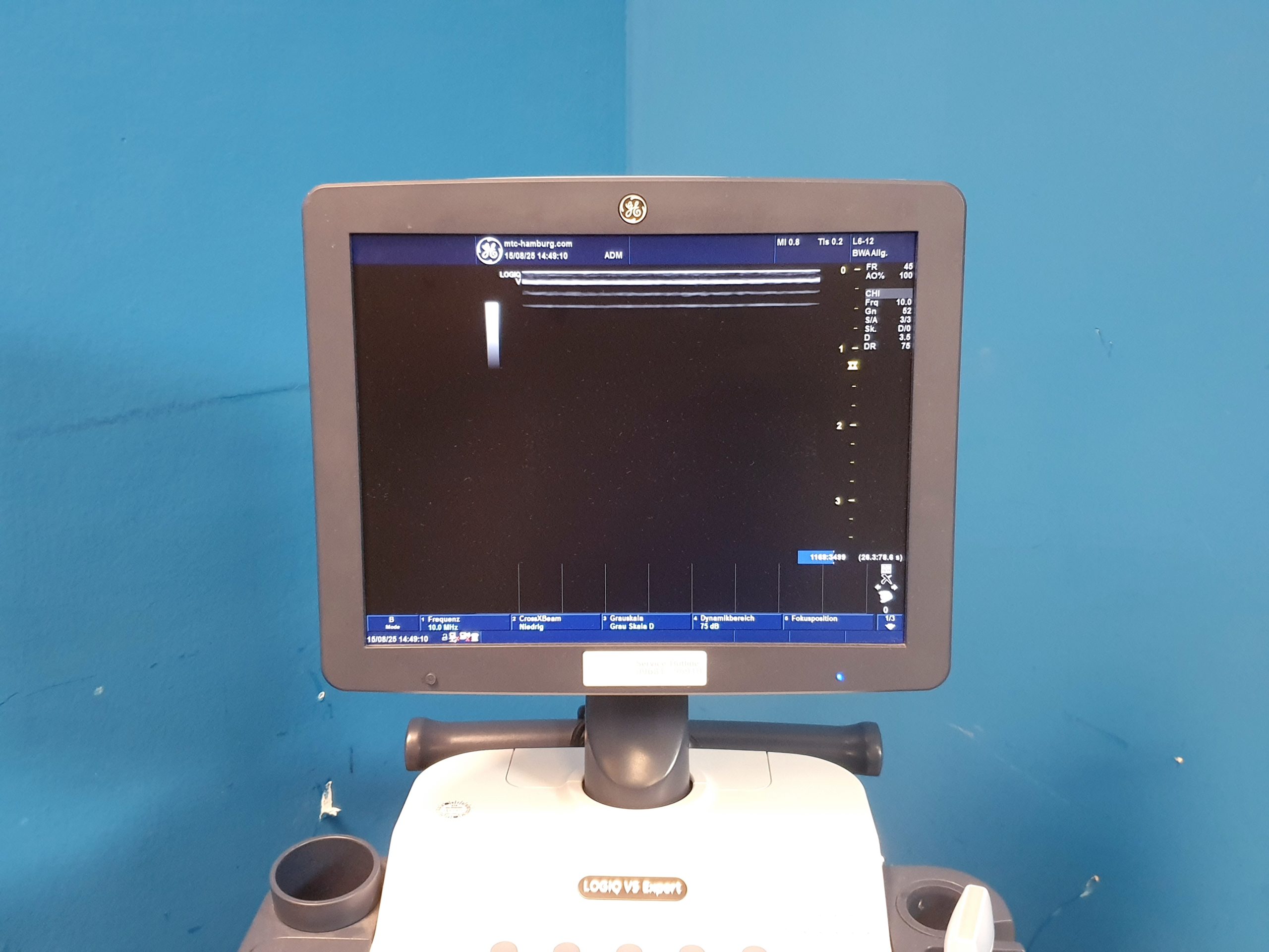GE Logiq V5 Expert Ultraschallgerät + L6-12 RS Linear Sonde DOM 2016 – Bild 17