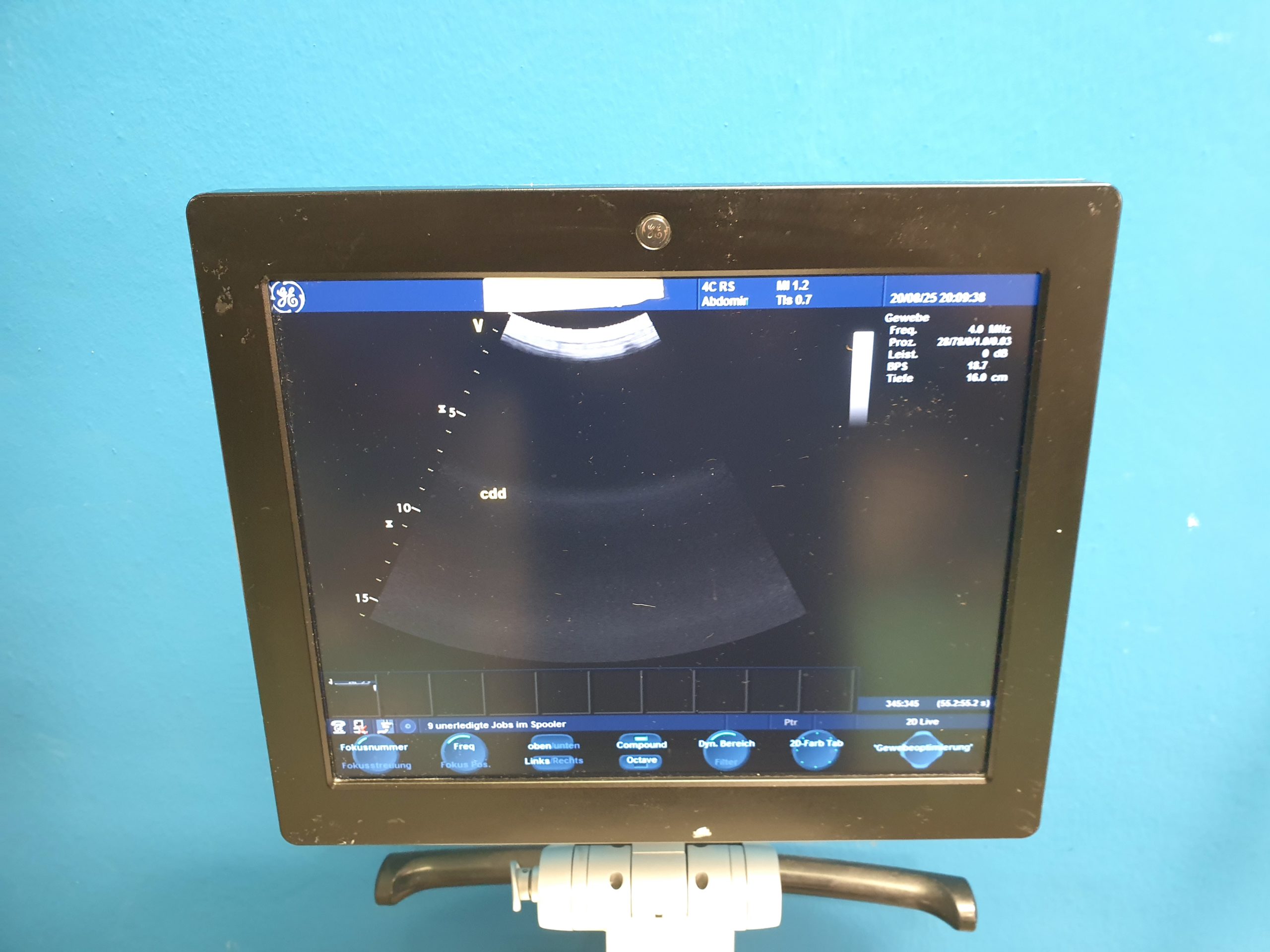 GE 4C-RS Convex Ultrasound Transducer – Bild 4