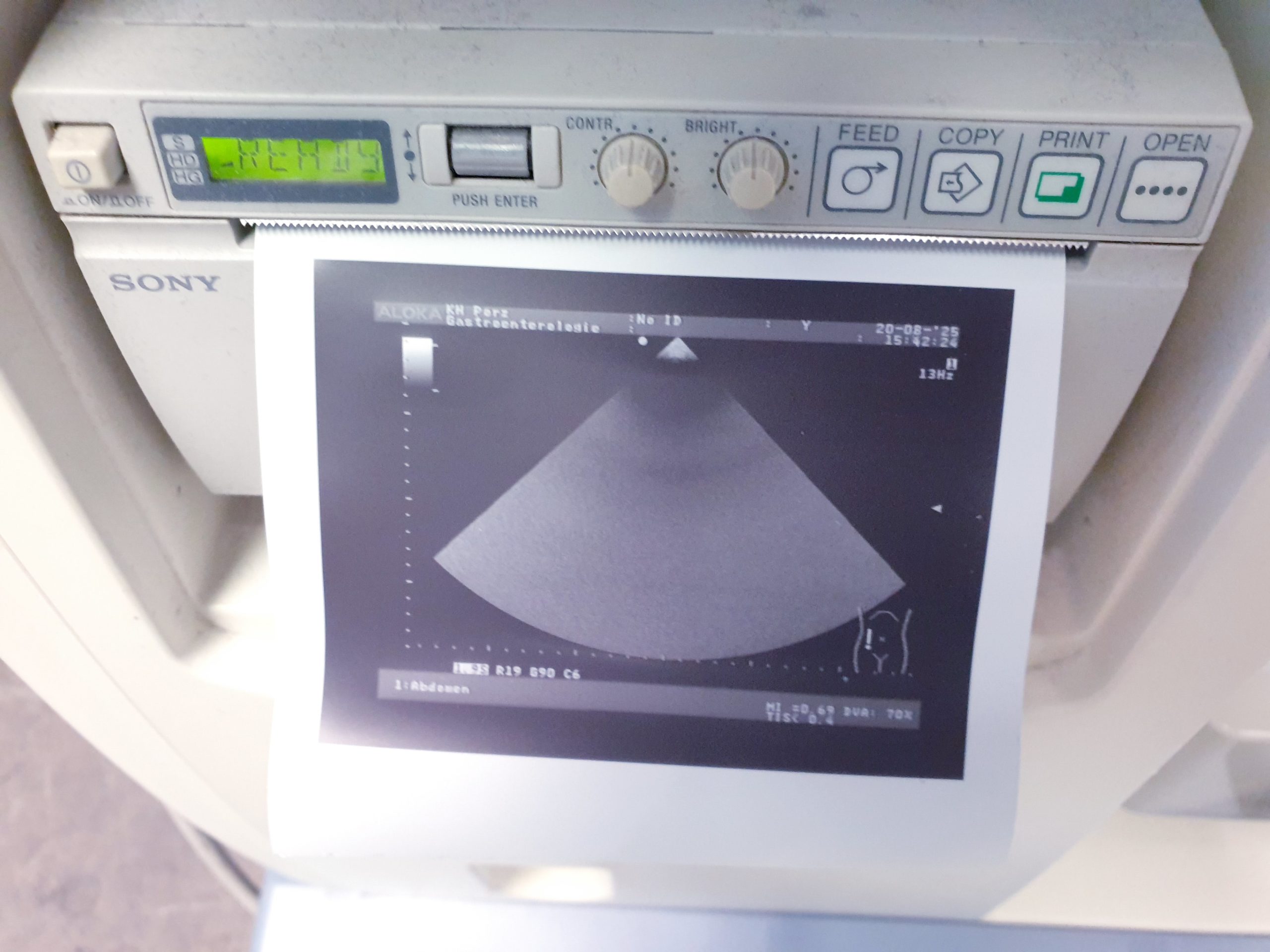 Aloka UST-52101 52101 Kardio – Echosonde – Bild 5