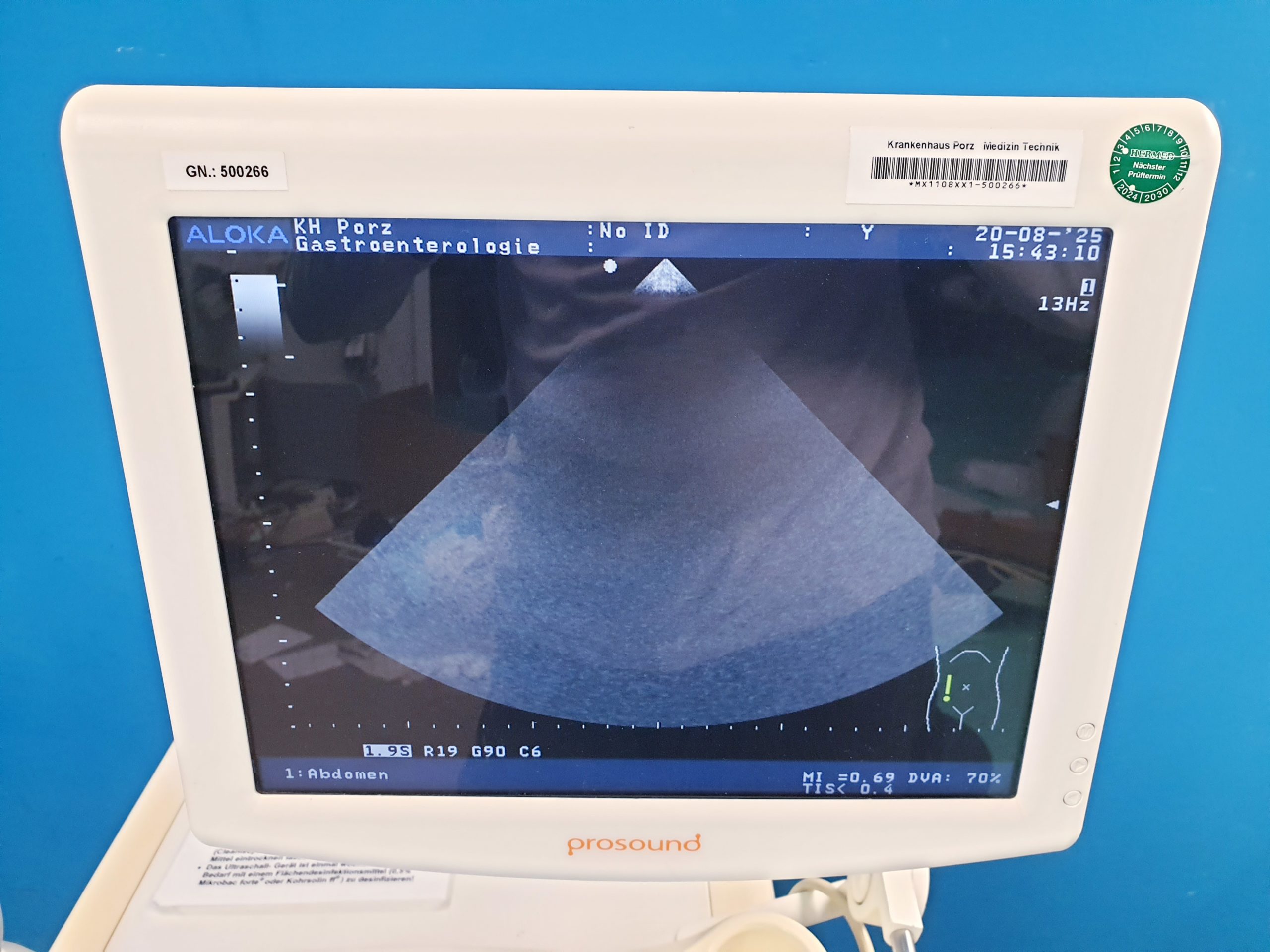 Aloka UST-52101 52101 Kardio – Echosonde – Bild 6
