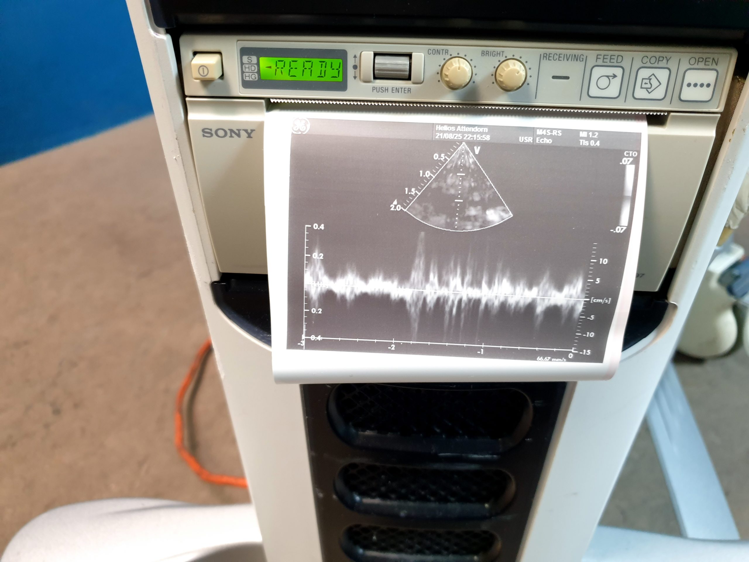 GE Vivid + M4S- RS Kardio Sonde -defekt - Optischer Fehler – Bild 10
