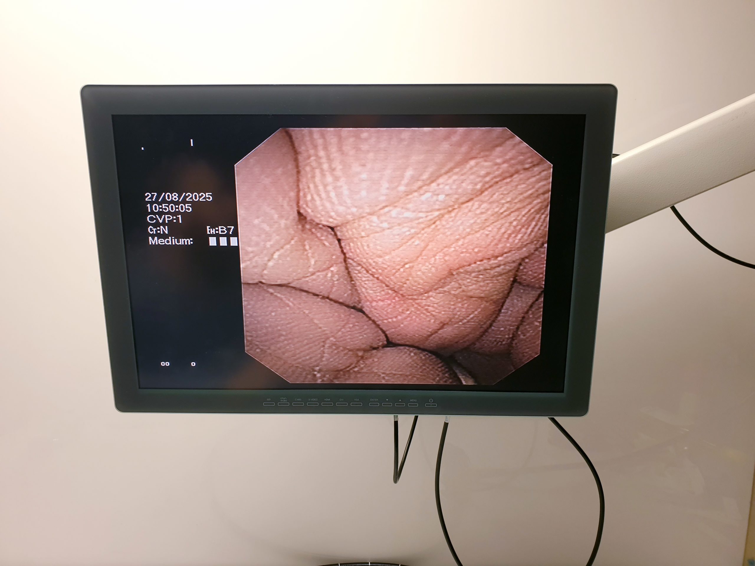 Olympus GF-UCT140-AL5 ULTRASONIC GASTROVIDEOSCOPE – Bild 18