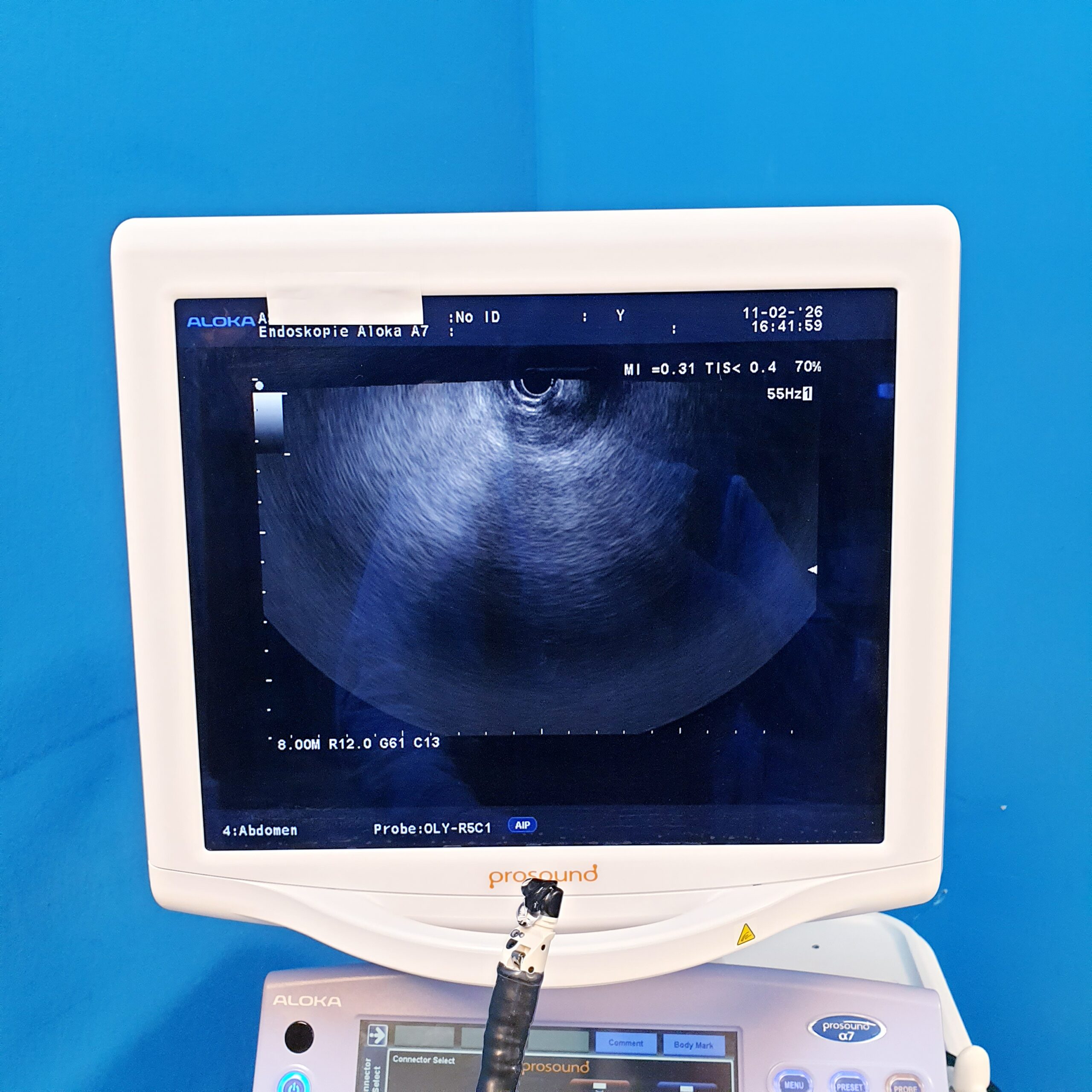 Olympus GF-UCT140-AL5 ULTRASONIC GASTROVIDEOSCOPE – Bild 28