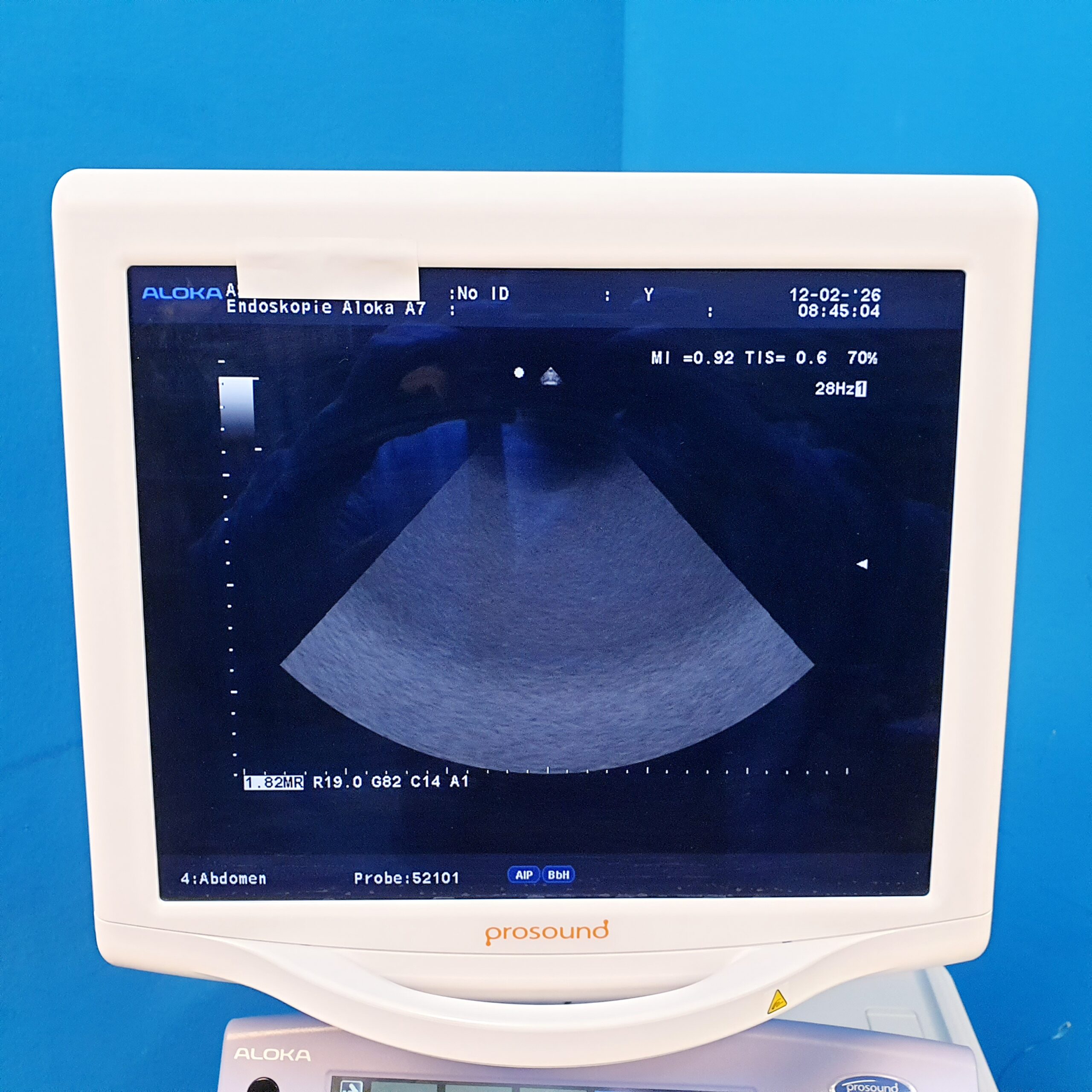 Aloka UST-52101 52101 Kardio – Echosonde – Bild 24