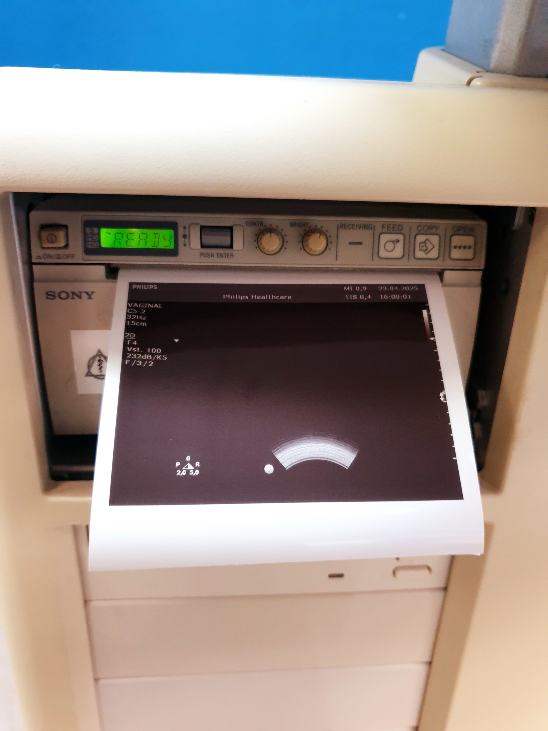 Philips C5-2 Konvex Sonde – Bild 4