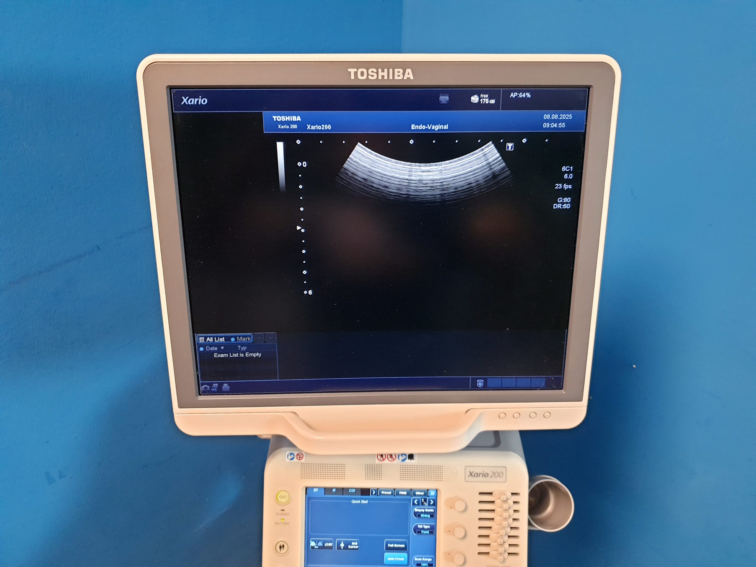 Toshiba TUS-X200 Xario 200 + 6C1 + 11C3 + 18L7 Konvex Linear Endovaginal – DOM2015 – Bild 10