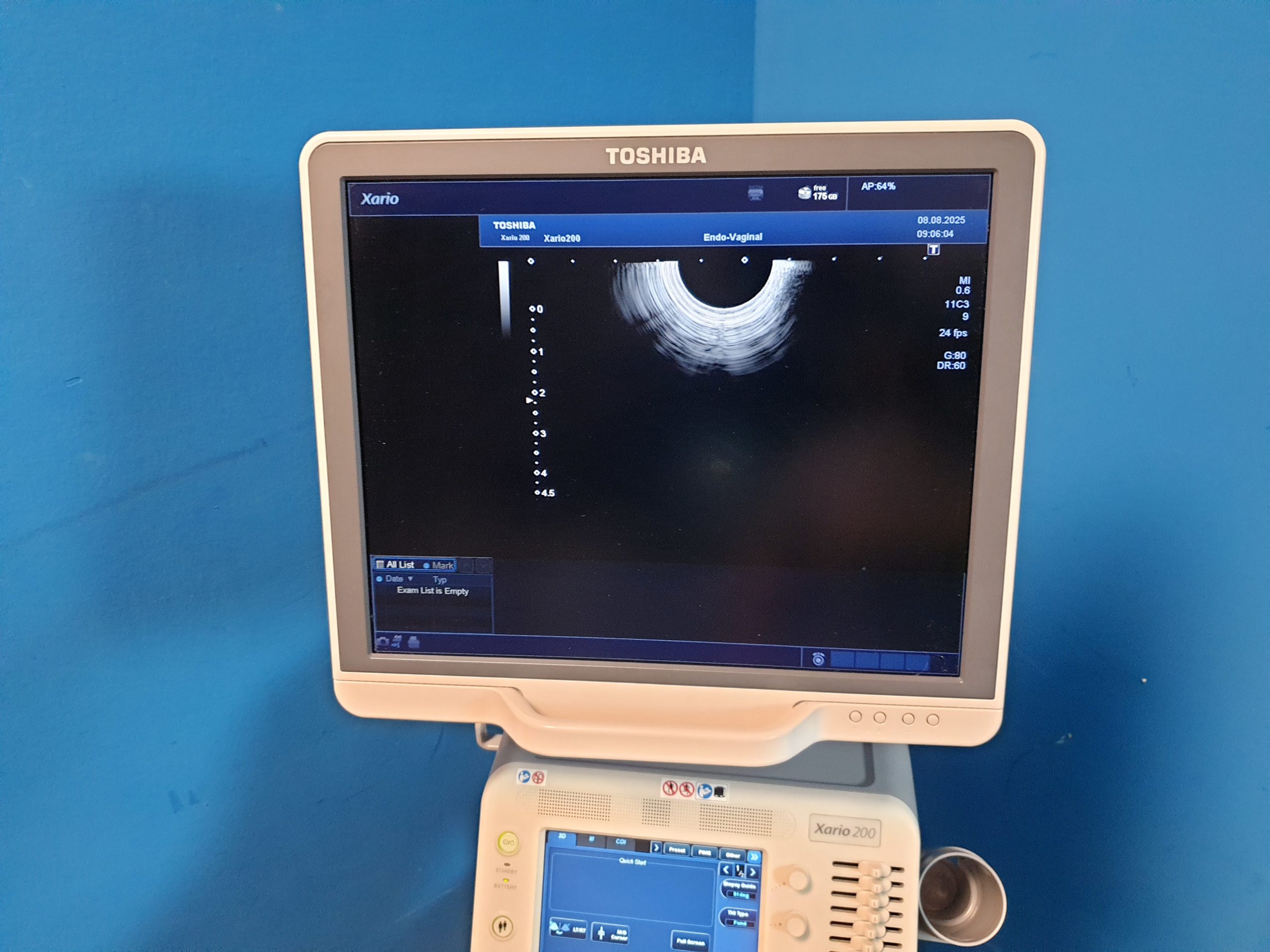 Toshiba TUS-X200 Xario 200 + 6C1 + 11C3 + 18L7 Konvex Linear Endovaginal – DOM2015 – Bild 12