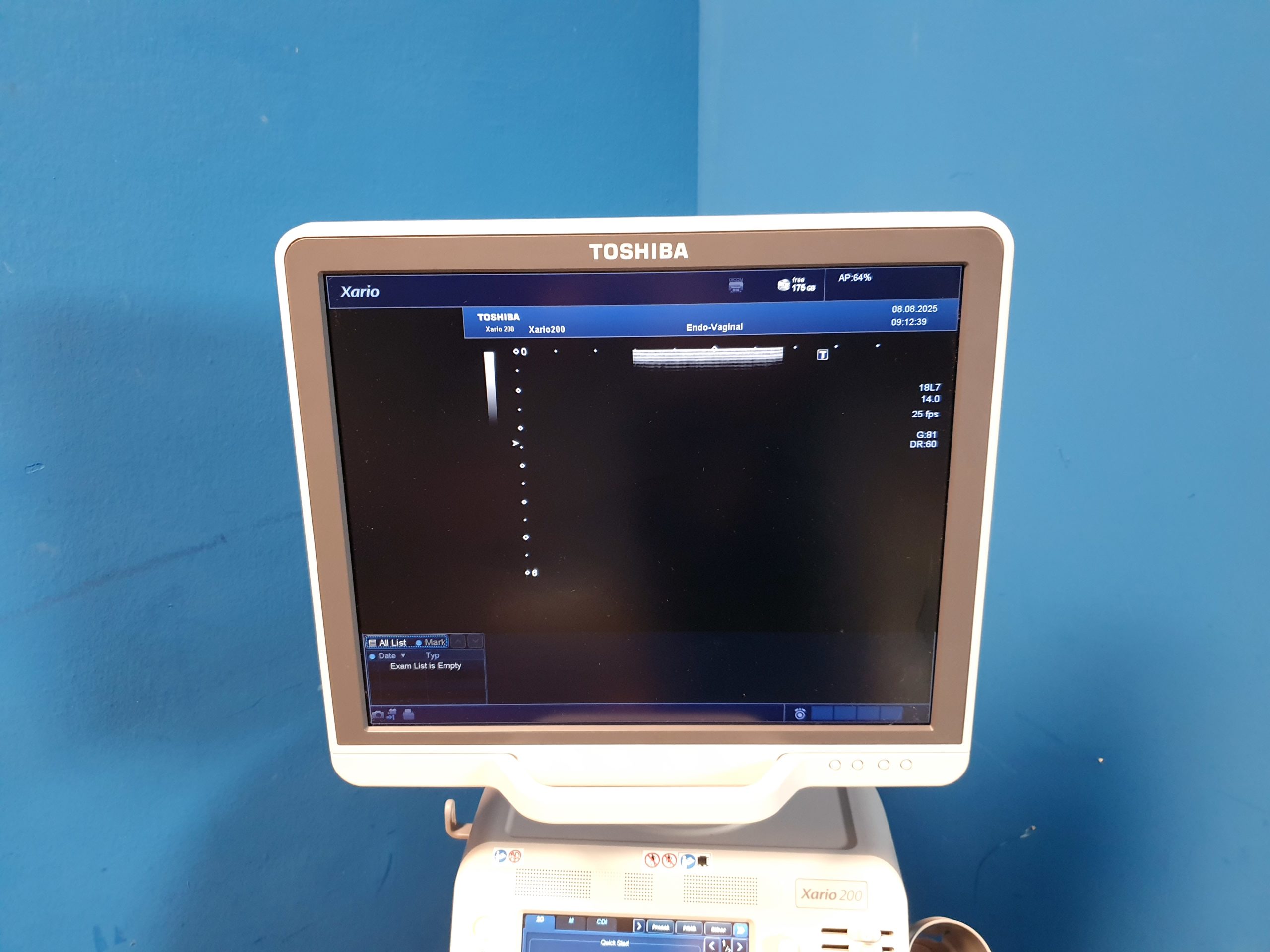 Toshiba TUS-X200 Xario 200 + 6C1 + 11C3 + 18L7 Konvex Linear Endovaginal – DOM2015 – Bild 14