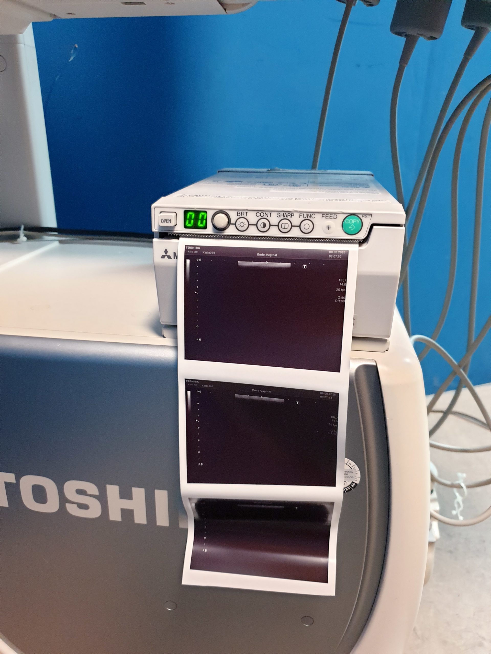 Toshiba TUS-X200 Xario 200 + 6C1 + 11C3 + 18L7 Konvex Linear Endovaginal – DOM2015 – Bild 16