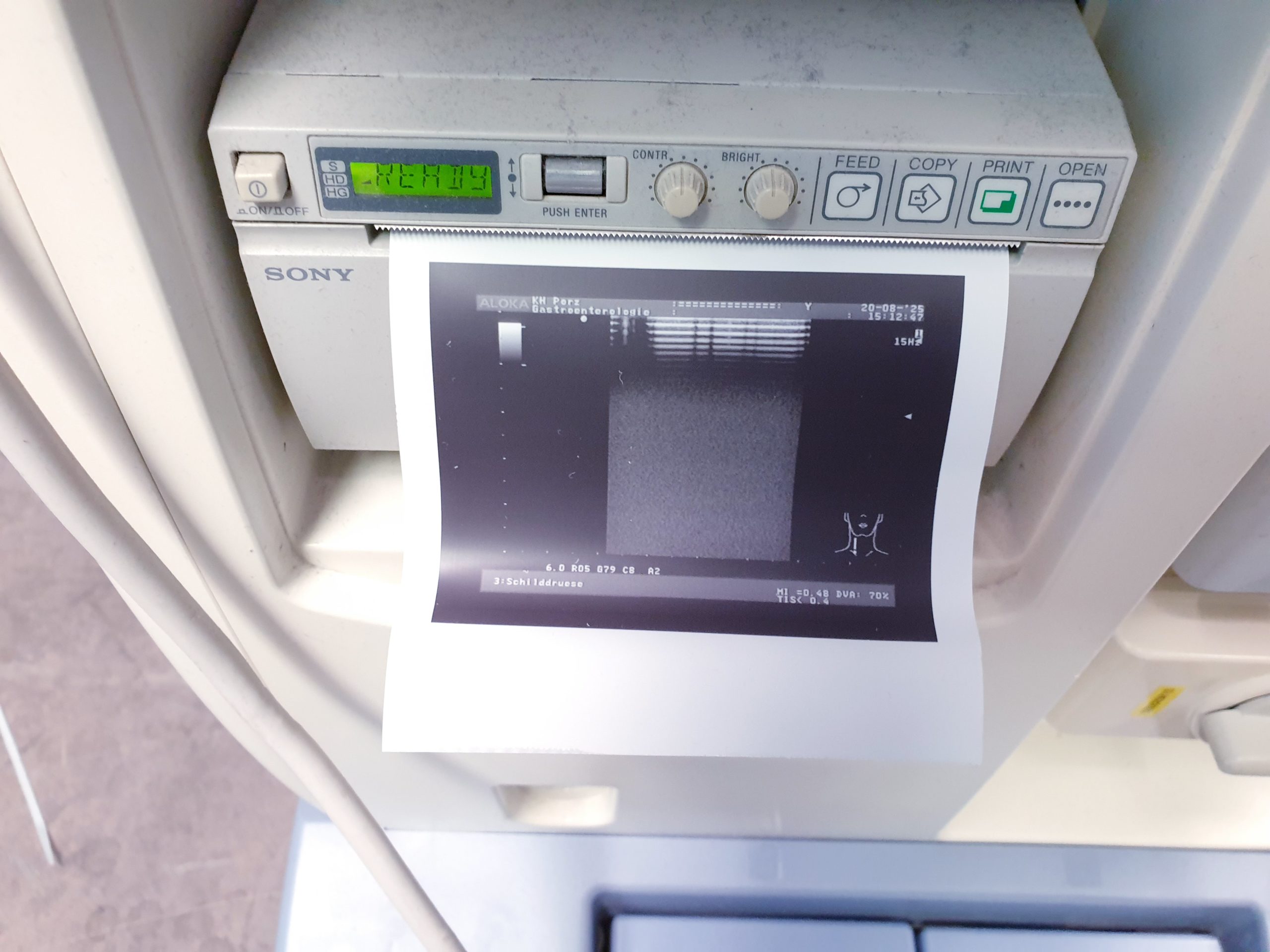 Aloka UST-5712 - UST 5712 Linearsonde – Bild 4