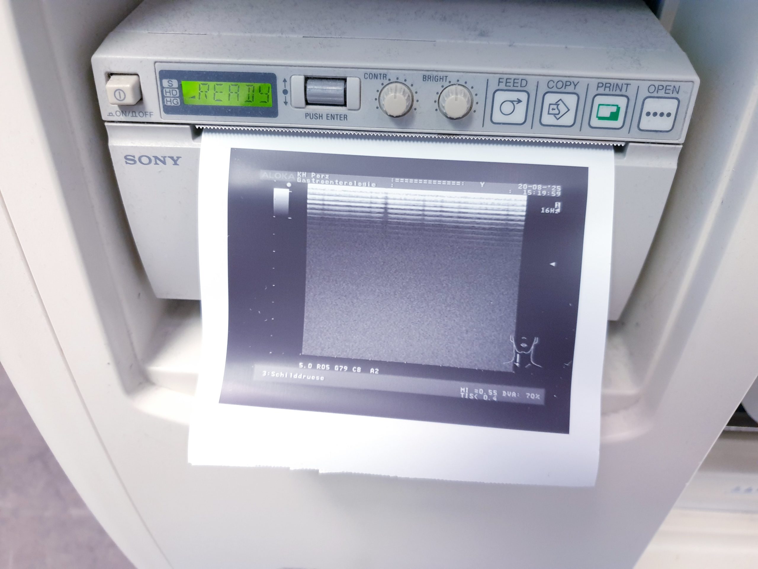 Aloka UST-5712 - UST 5712 Linearsonde – Bild 22