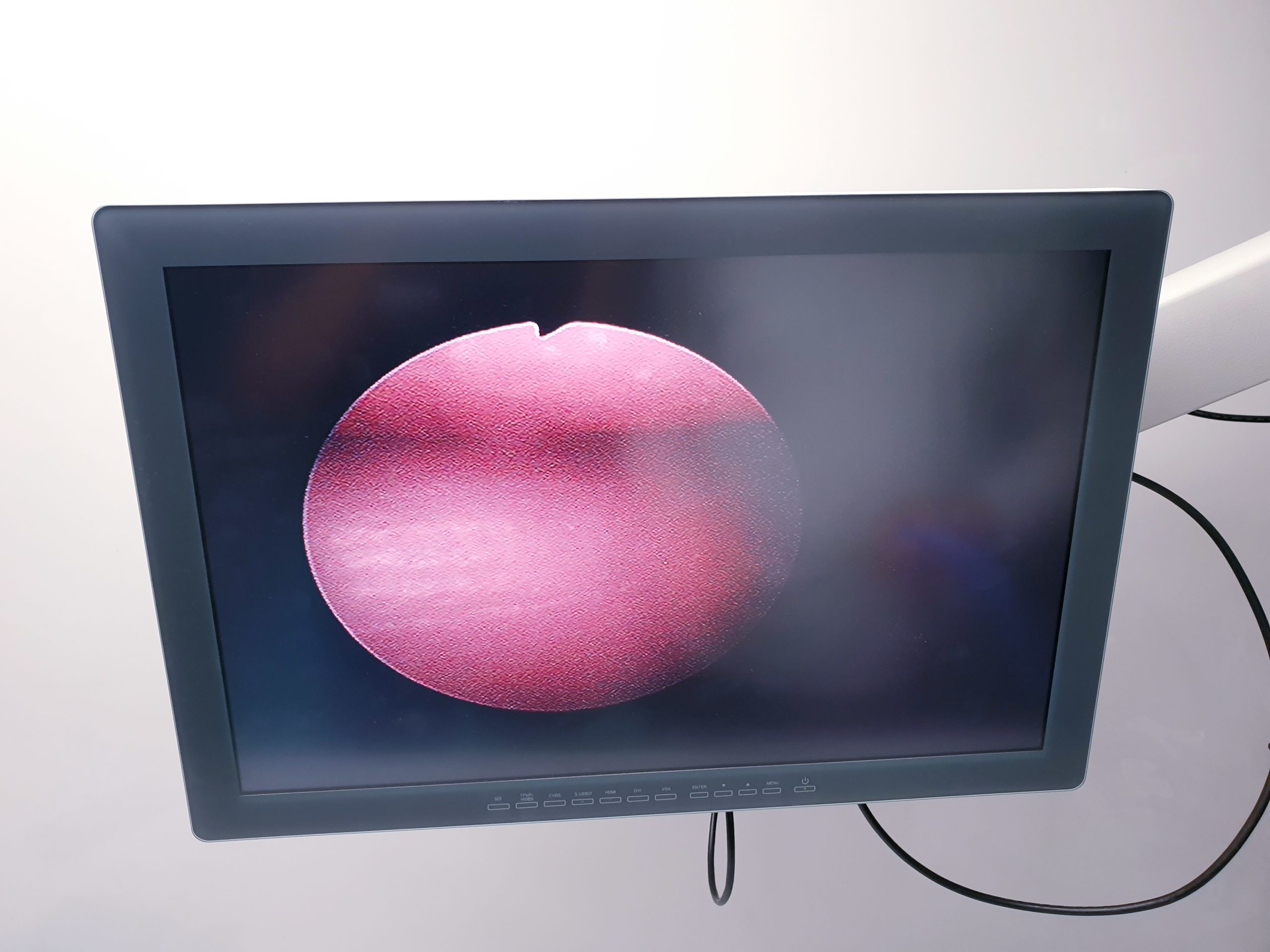 Olympus A70961A Arthroscope 30° 2.7 mm 160 mm – Bild 8