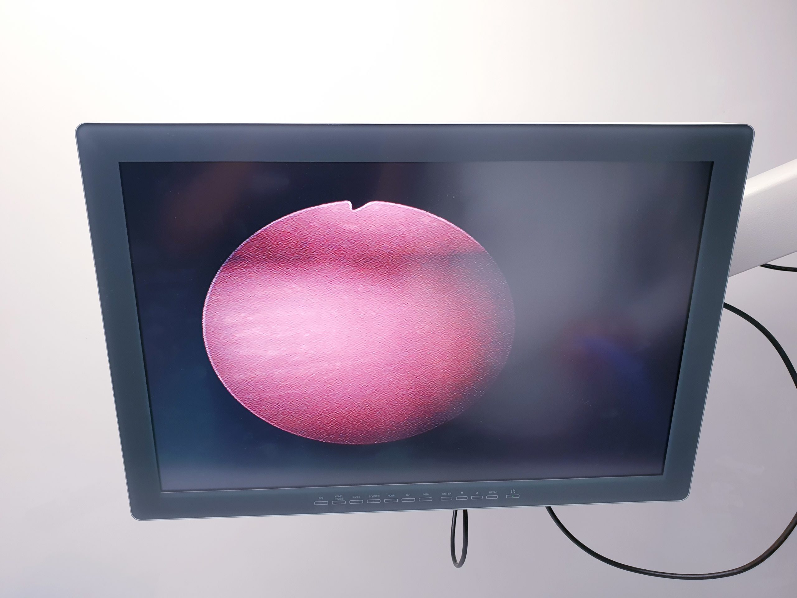 Olympus A70961A Arthroscope 30° 2.7 mm 160 mm – Bild 9