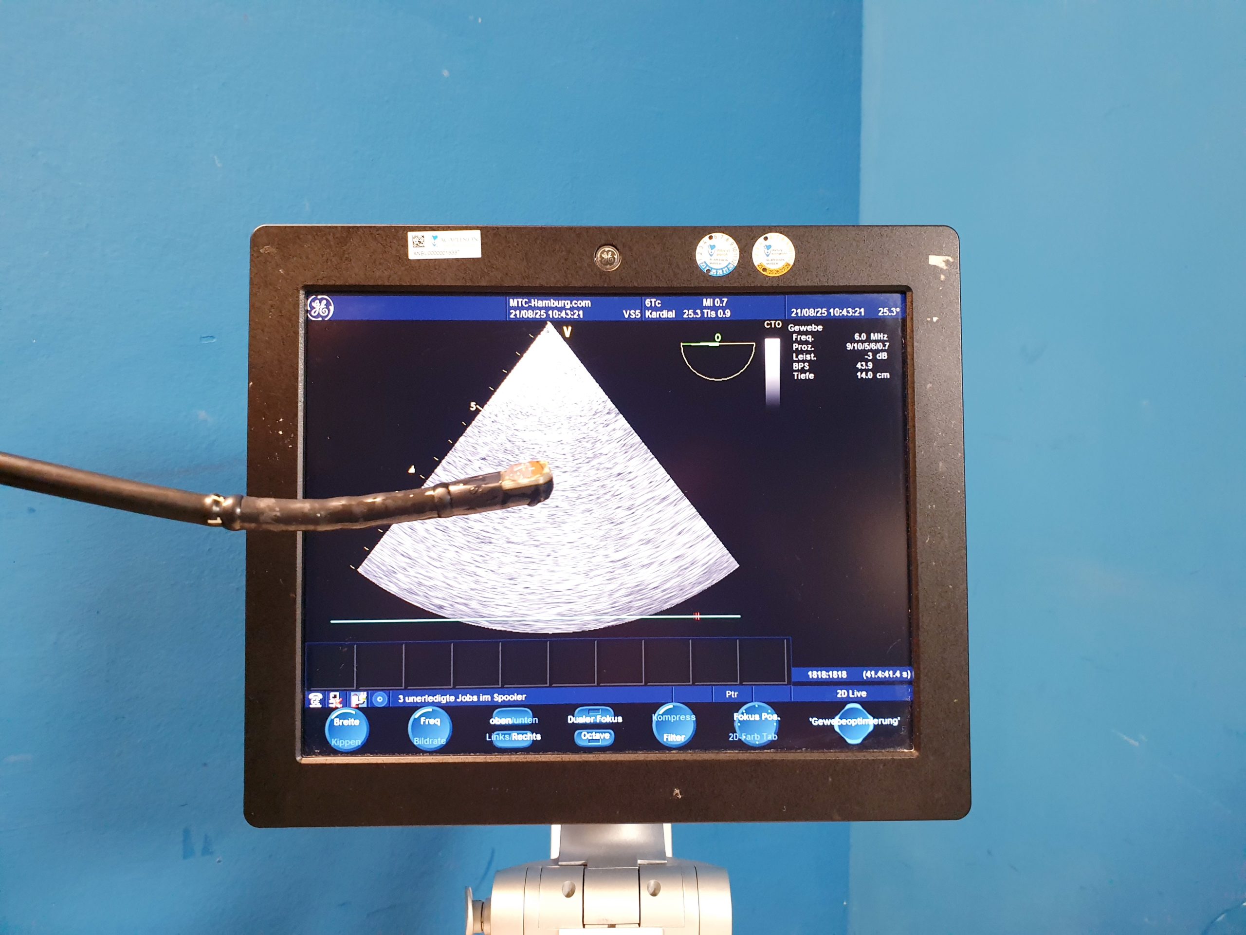 GE HEALTHCARE 6Tc-RS Medical TEE-Probe – Bild 5