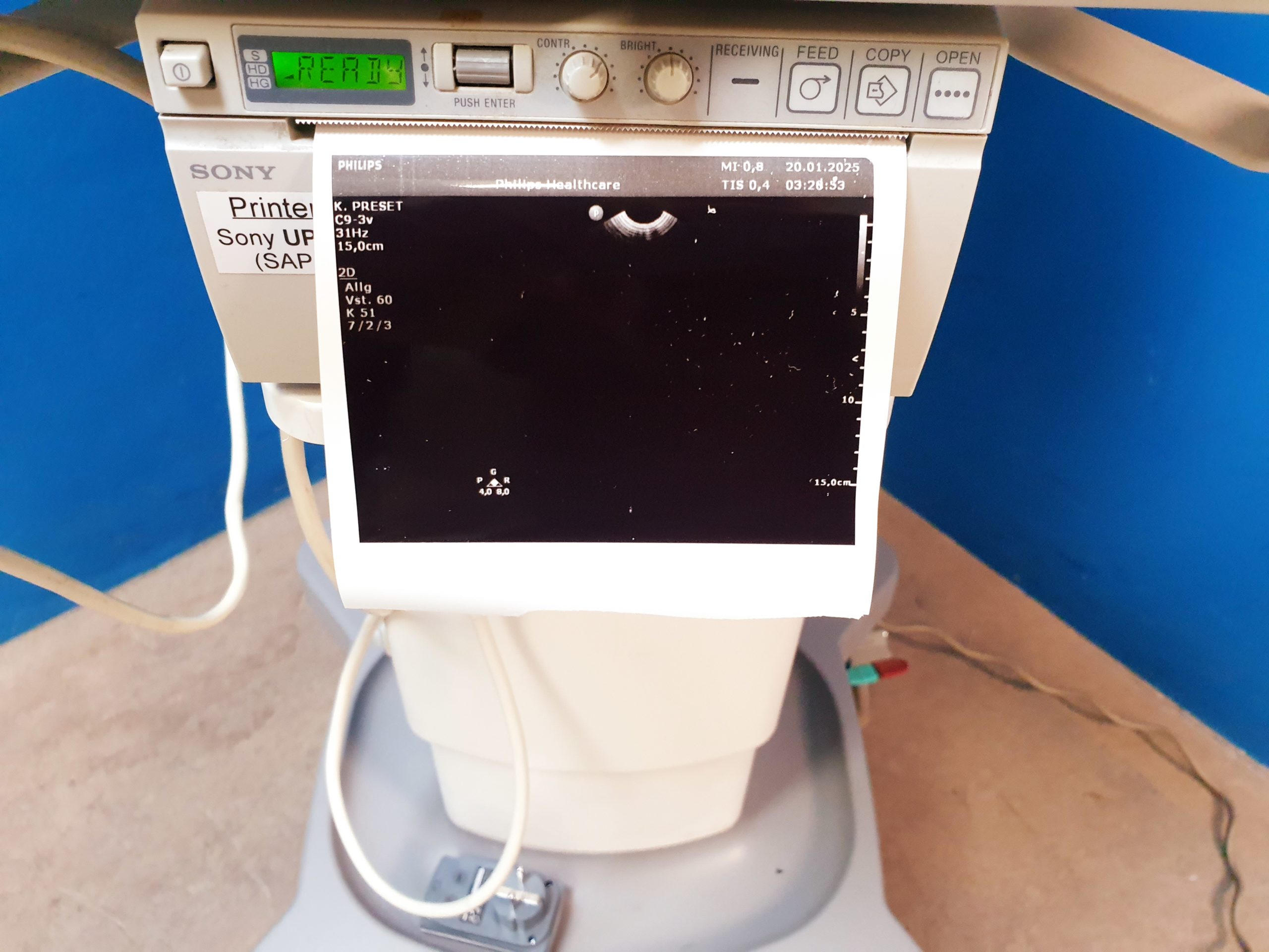 Philips Transducer C9-3V Ultrasound Probe – Bild 4