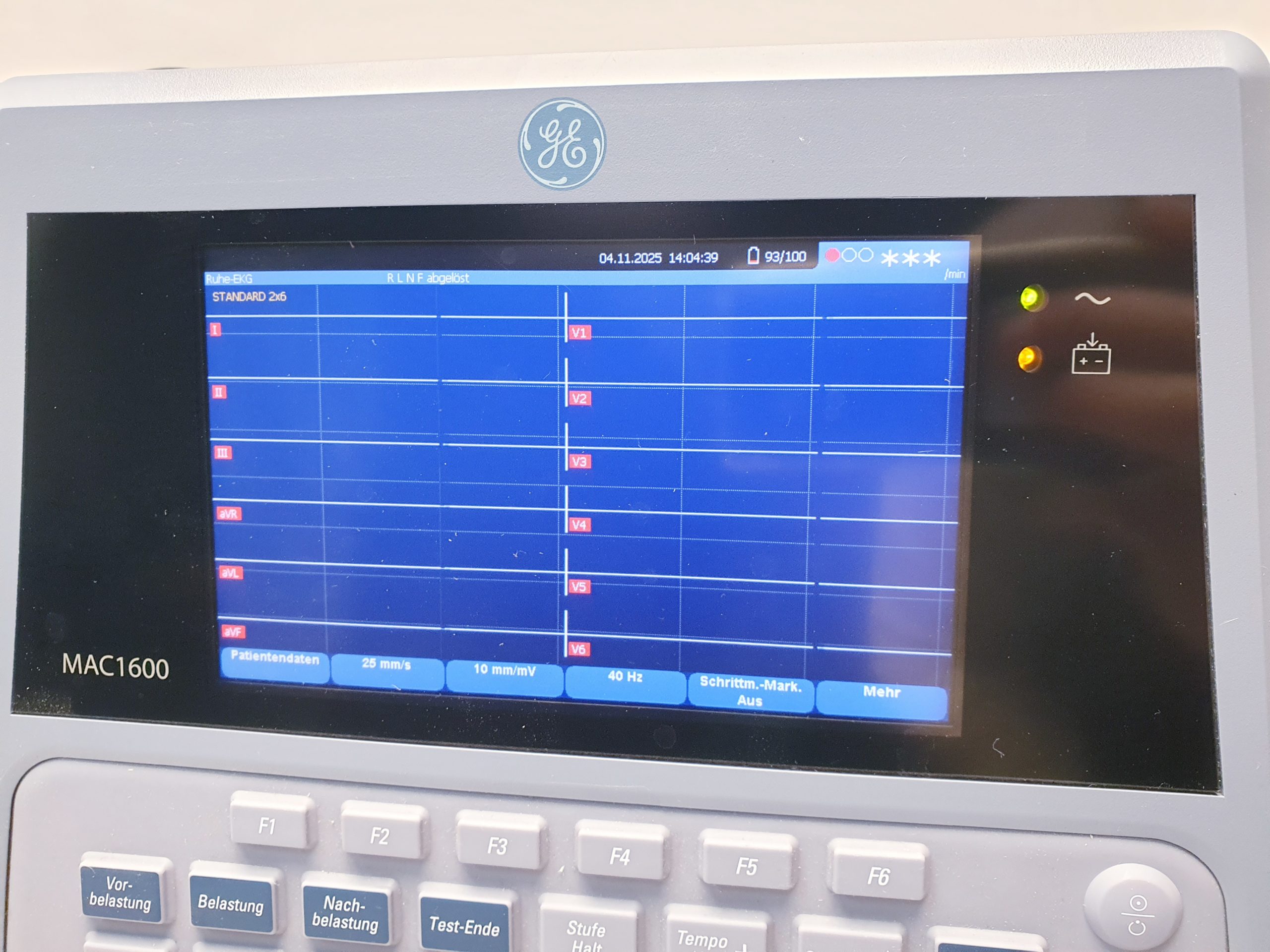 GE MAC 1600 EKG Gerät – Bild 11