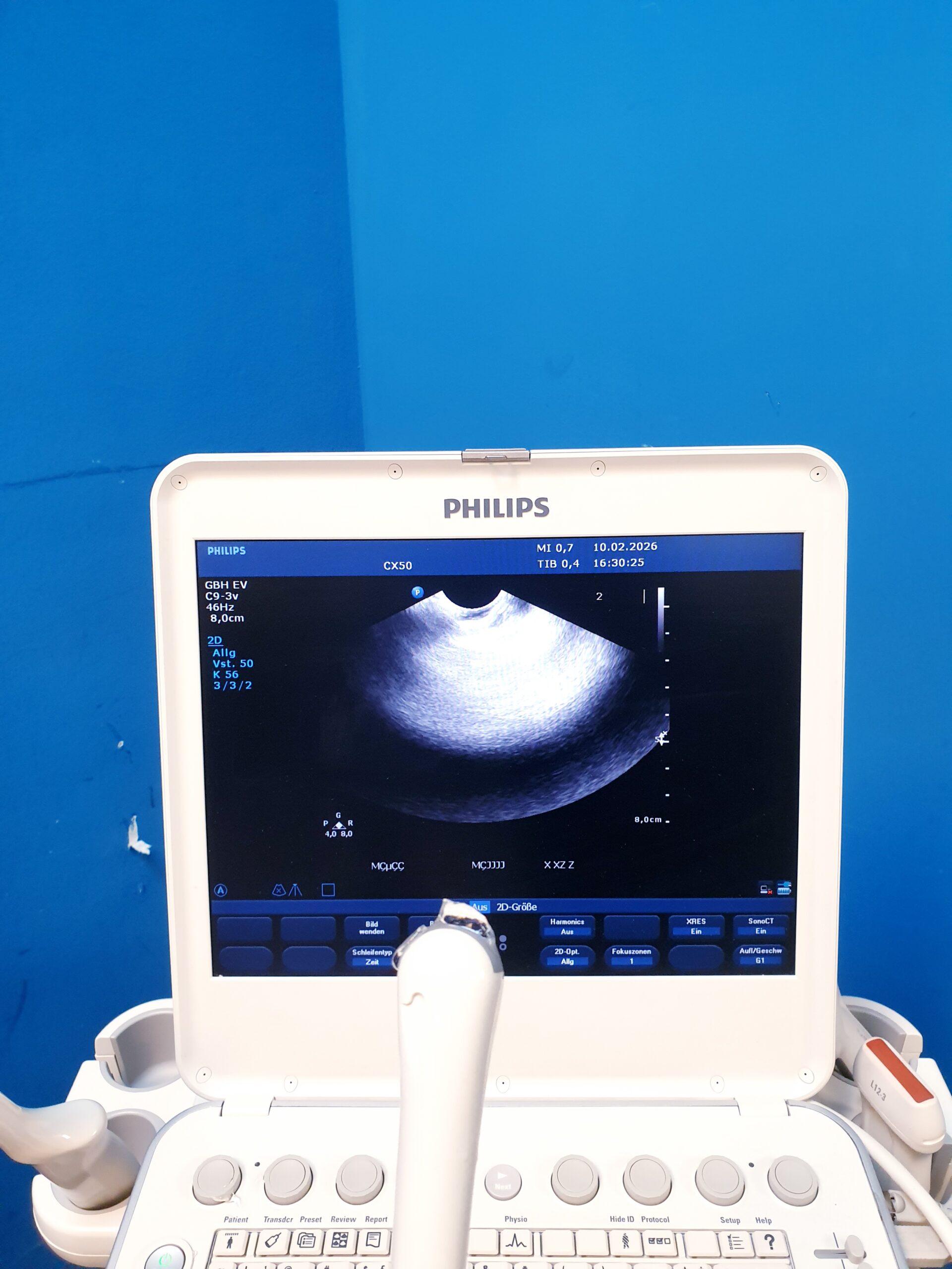 Philips Transducer C9-3V Ultrasound Probe – Bild 24
