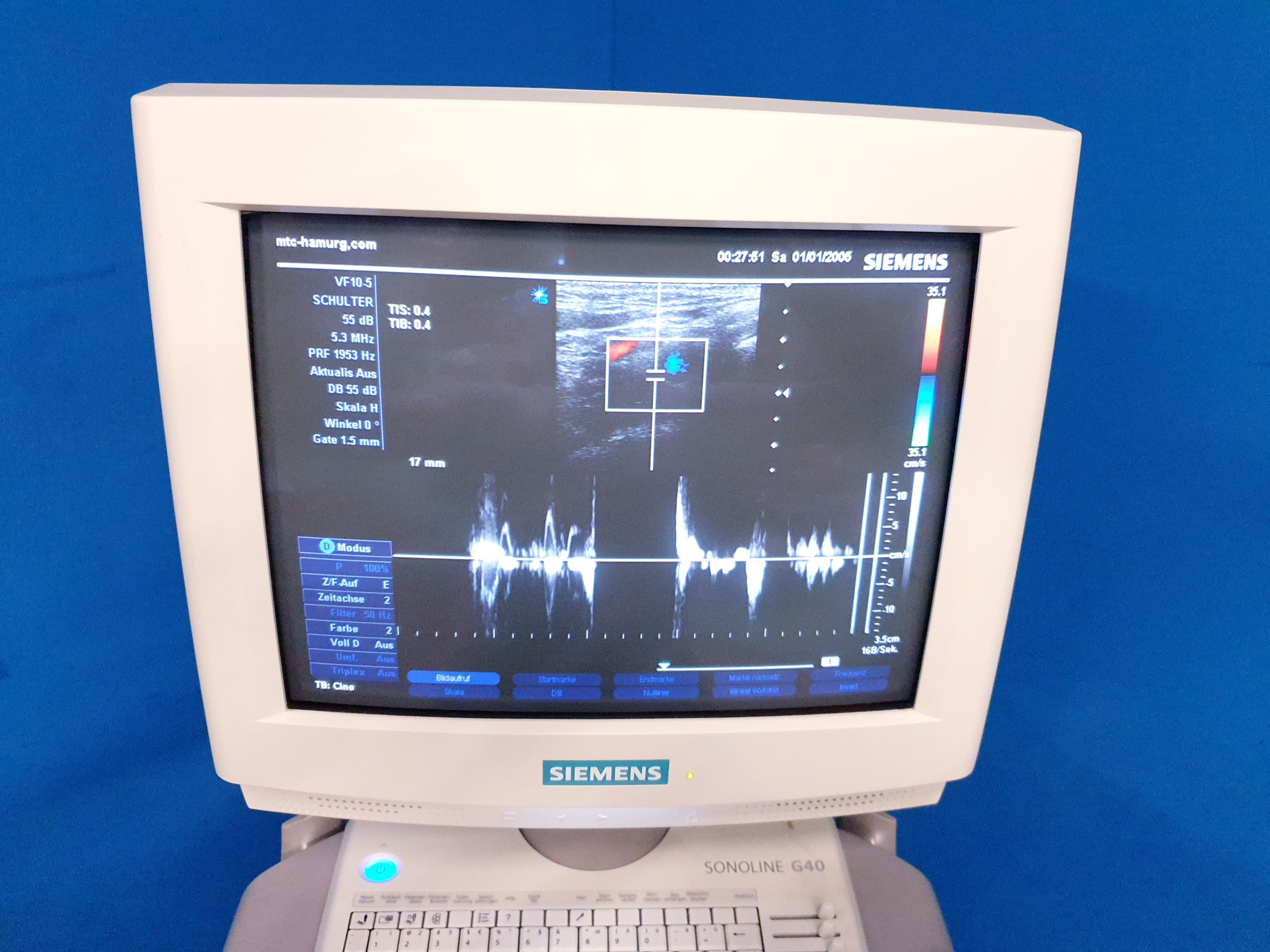 Siemens Sonoline G40 - G 40 Ultraschall +L9-5 linear+ VF10-5 Lineare Sonde – Bild 5