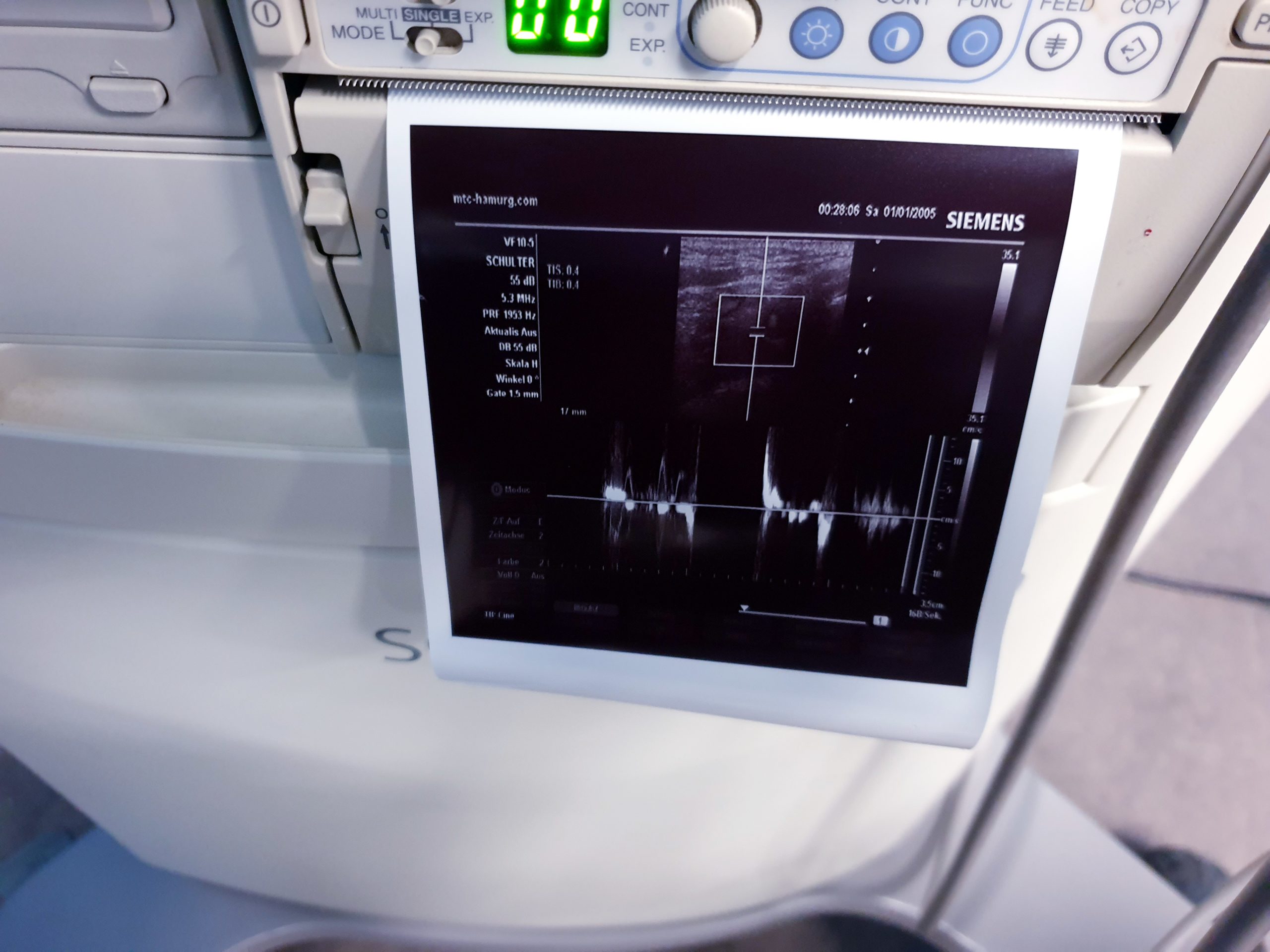 Siemens Sonoline G40 - G 40 Ultraschall +L9-5 linear+ VF10-5 Lineare Sonde – Bild 6