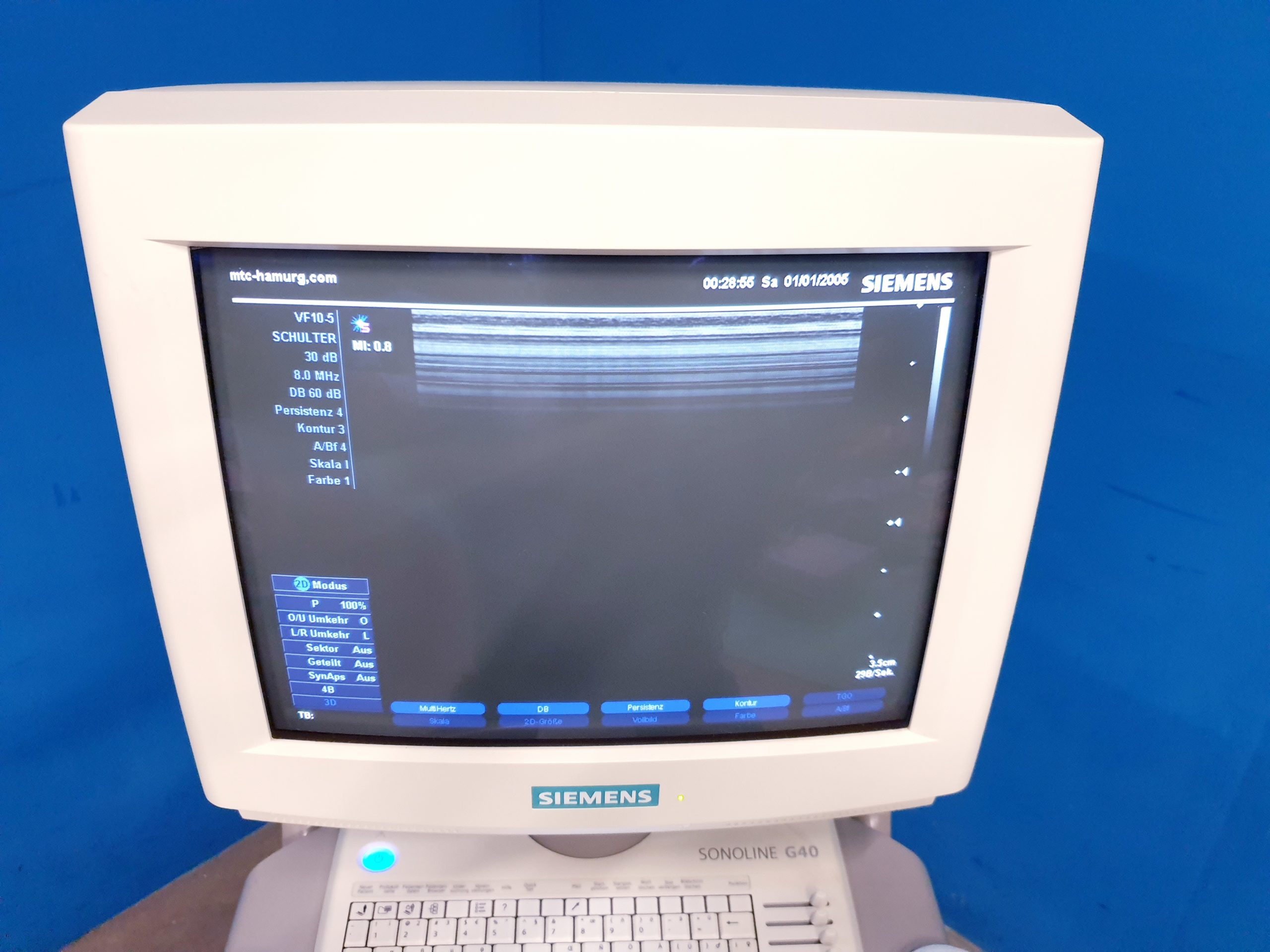 Siemens Sonoline G40 - G 40 Ultraschall +L9-5 linear+ VF10-5 Lineare Sonde – Bild 9