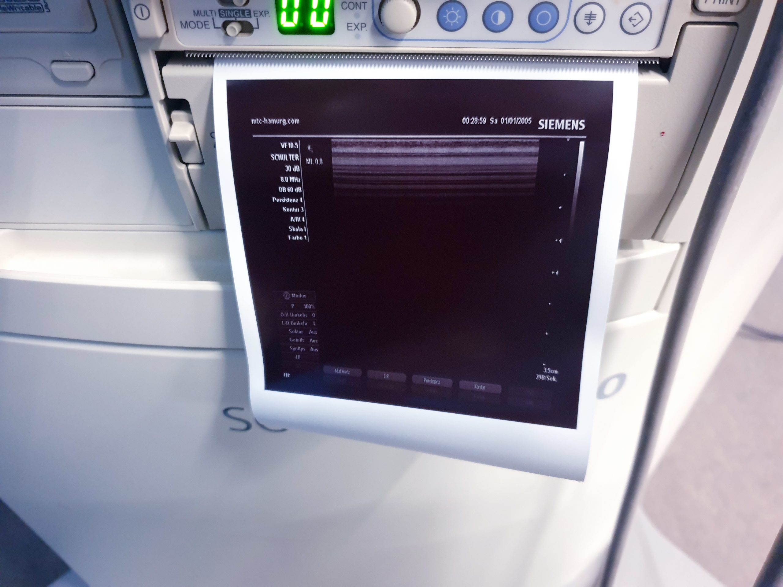 Siemens Sonoline G40 - G 40 Ultraschall +L9-5 linear+ VF10-5 Lineare Sonde – Bild 10