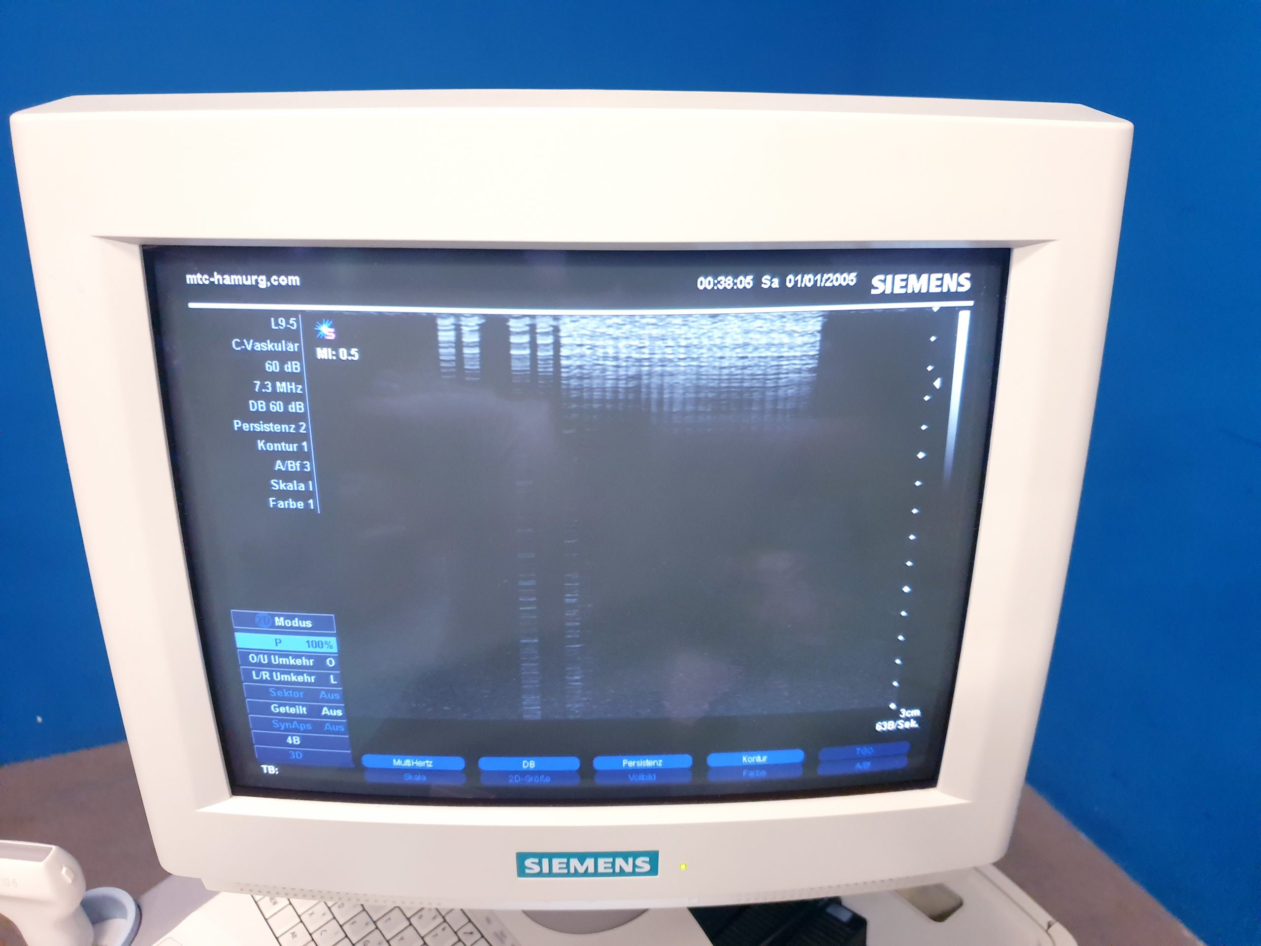 Siemens Sonoline G40 - G 40 Ultraschall +L9-5 linear+ VF10-5 Lineare Sonde – Bild 14