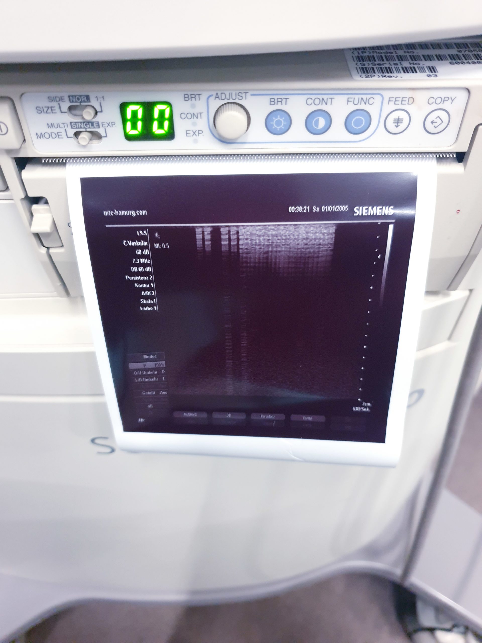 Siemens Sonoline G40 - G 40 Ultraschall +L9-5 linear+ VF10-5 Lineare Sonde – Bild 15