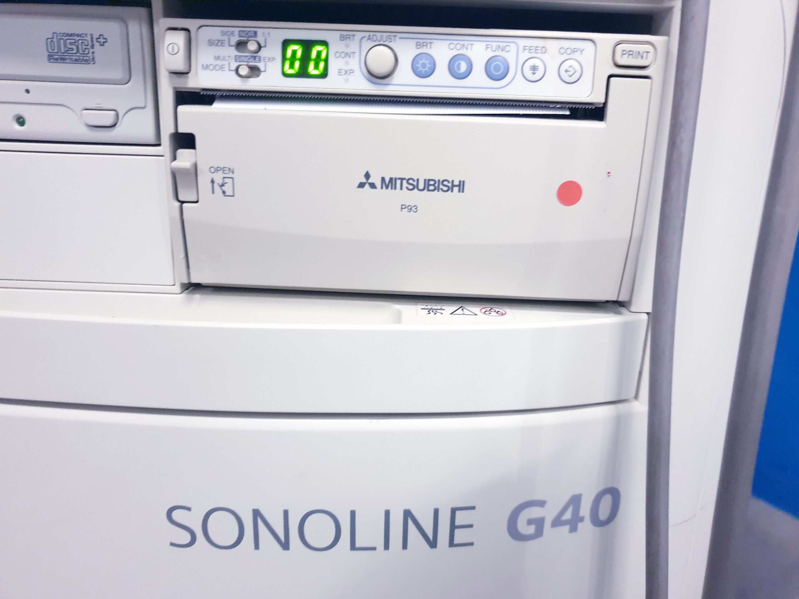 Siemens Sonoline G40 - G 40 Ultraschall +L9-5 linear+ VF10-5 Lineare Sonde – Bild 18