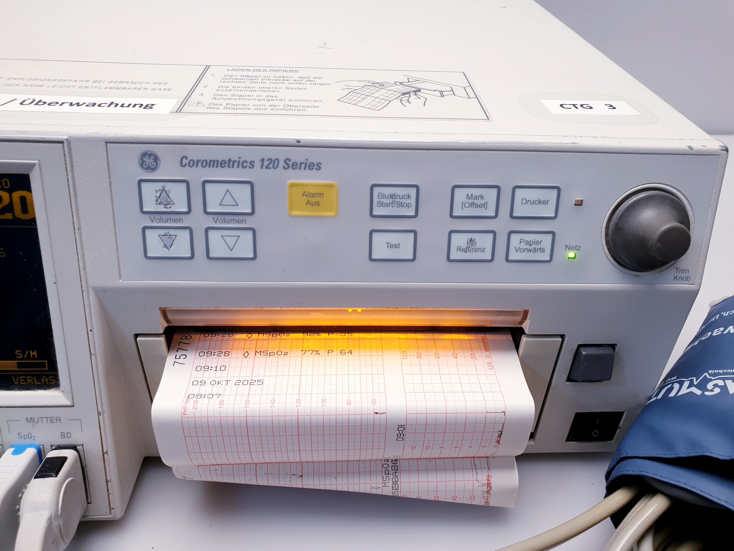 Corometrics 120 series CTG + SpO2 Sensor + Aufnehmen – Bild 14