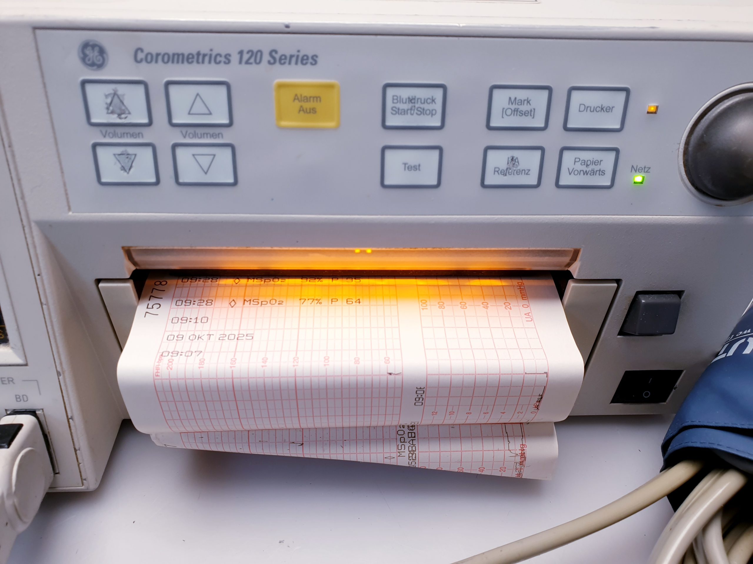 Corometrics 120 series CTG + SpO2 Sensor + Aufnehmen – Bild 15