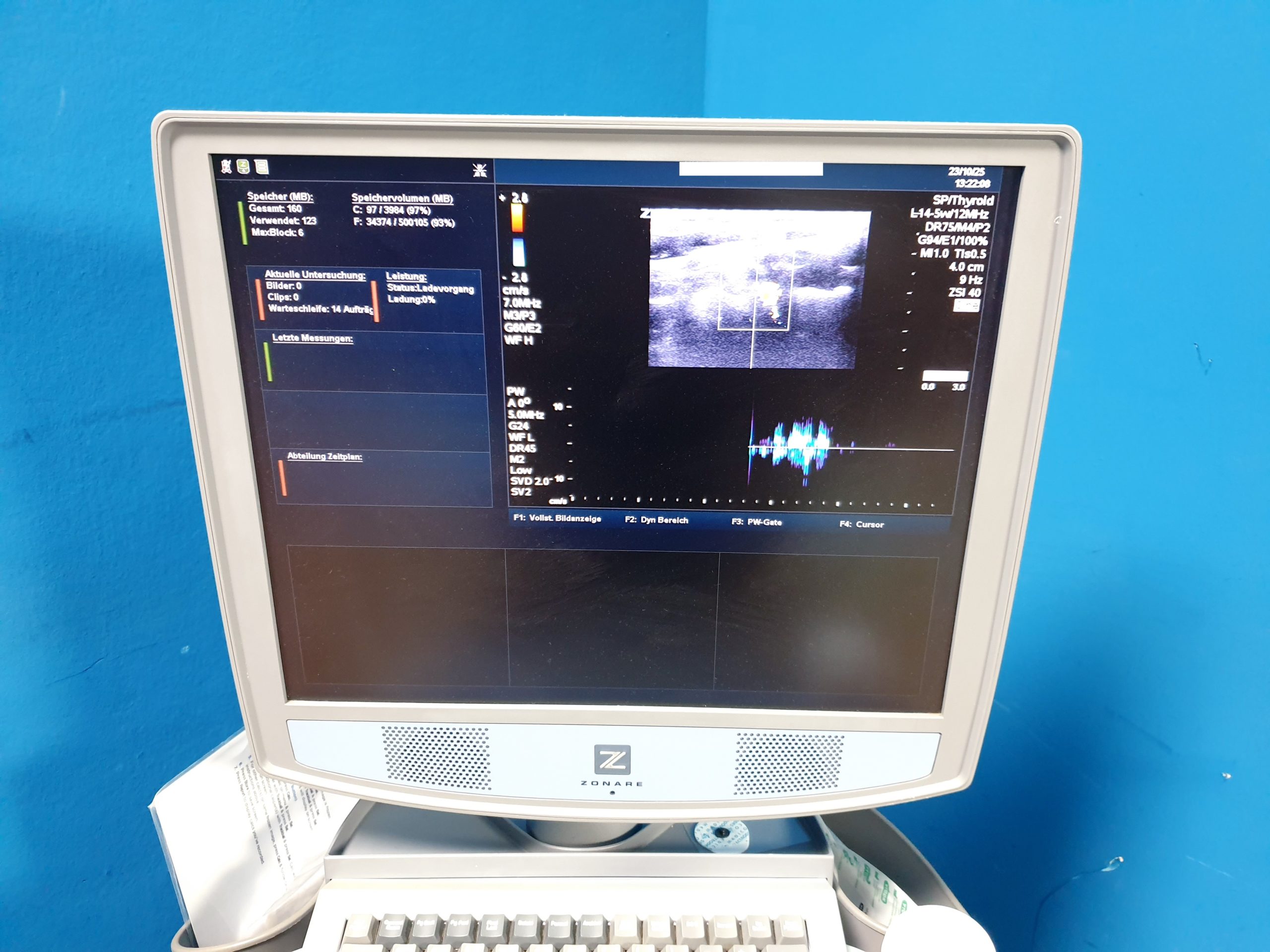 Zonare - Doppler Farbdoppler Ultraschallsystem 3 Sonden L14-5w + C9-3 + C10-3 – Bild 7