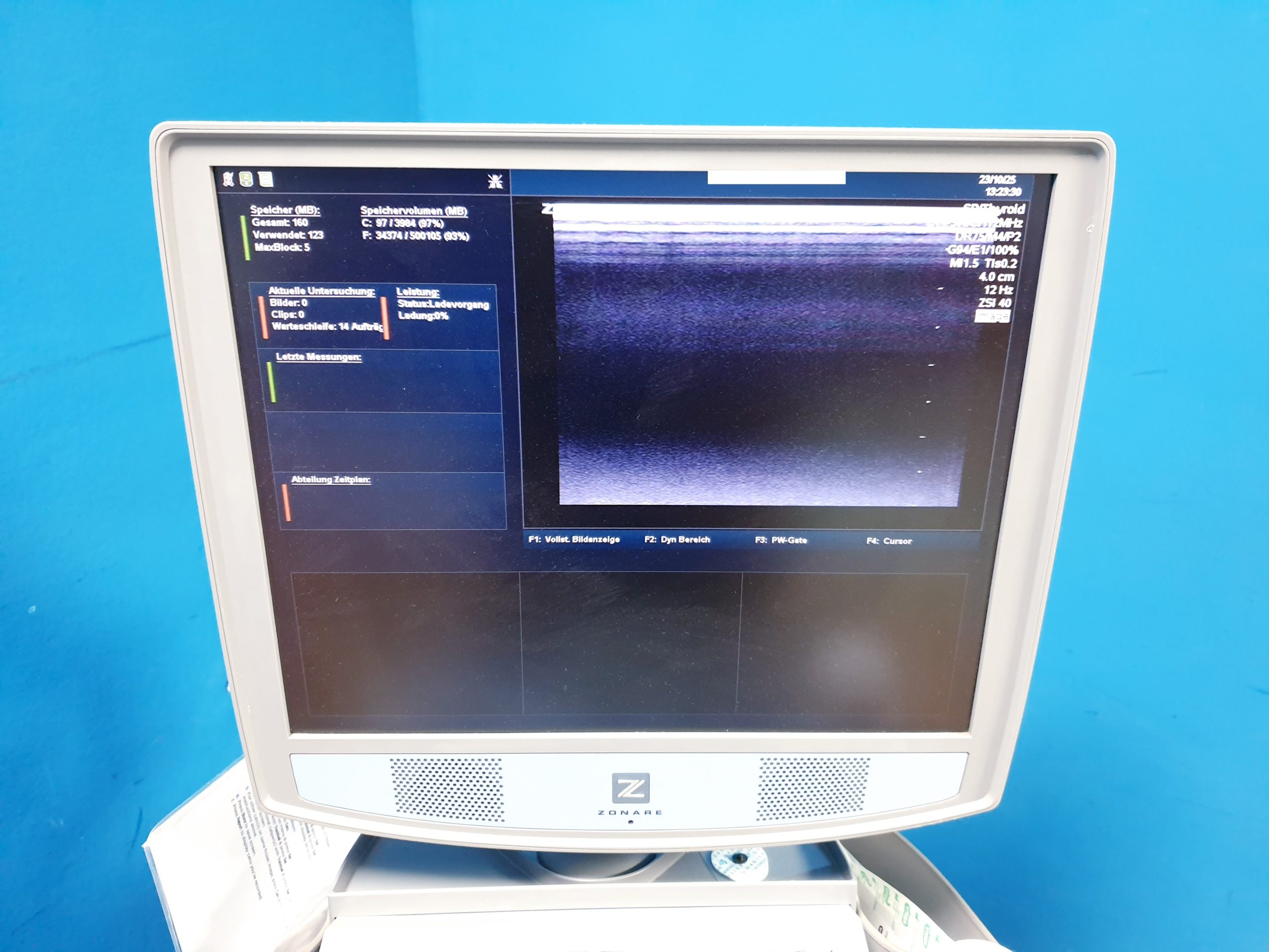 Zonare - Doppler Farbdoppler Ultraschallsystem 3 Sonden L14-5w + C9-3 + C10-3 – Bild 10