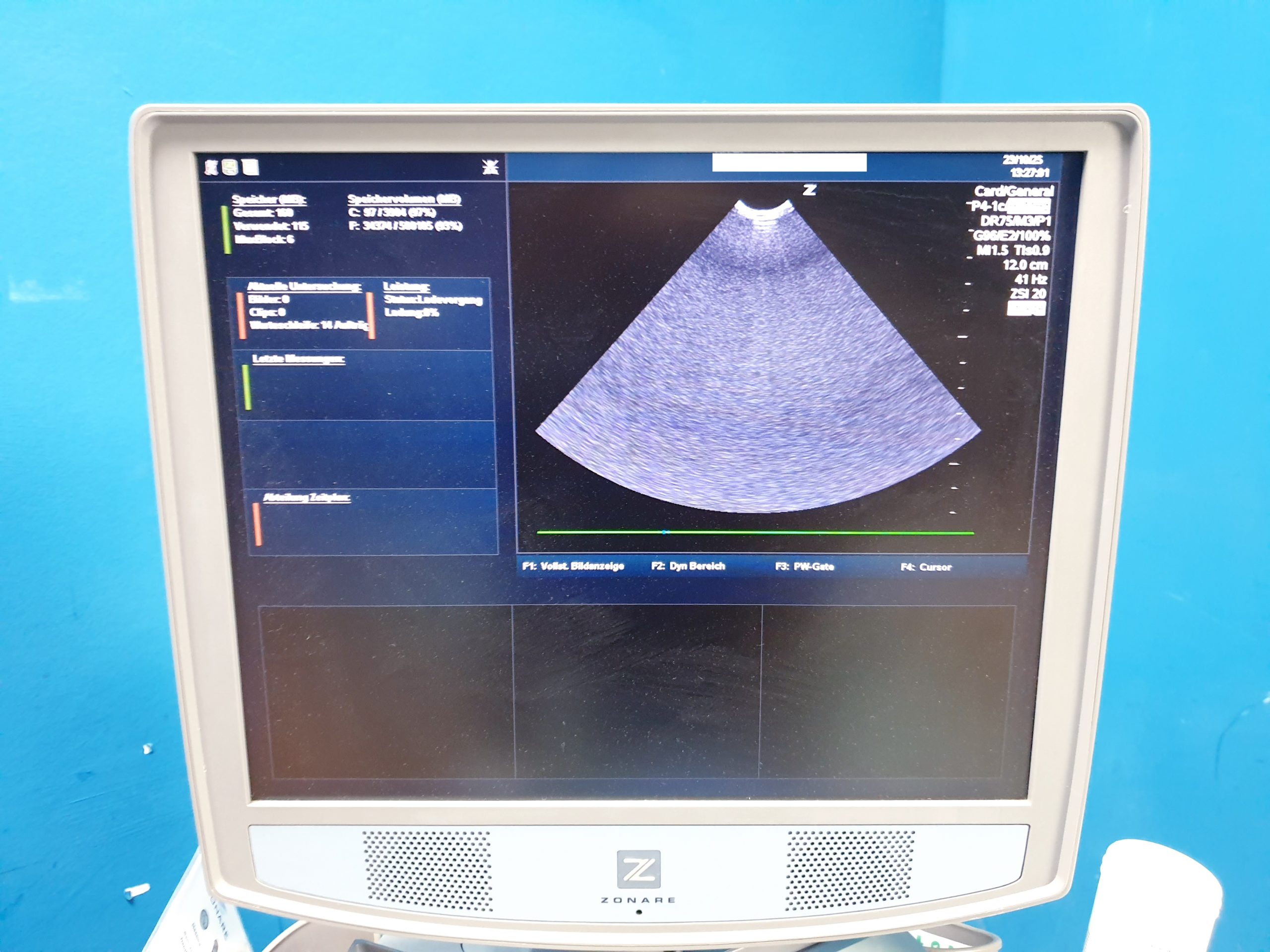 Zonare - Doppler Farbdoppler Ultraschallsystem 3 Sonden L14-5w + C9-3 + C10-3 – Bild 21