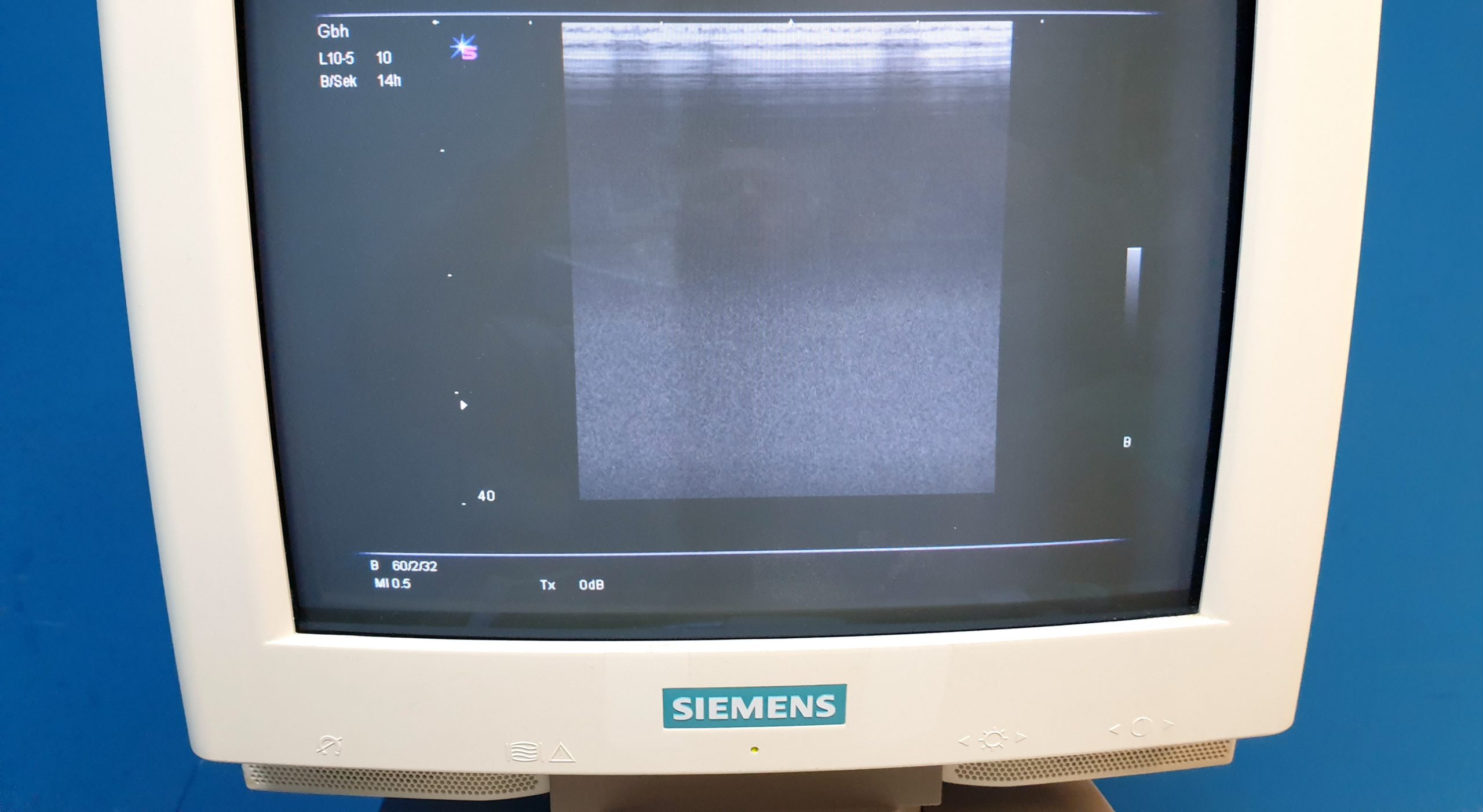 Siemens L10-5 Schallkopf L10-5 (07472660), Ultraschallwandler, Linearsonde – Bild 5