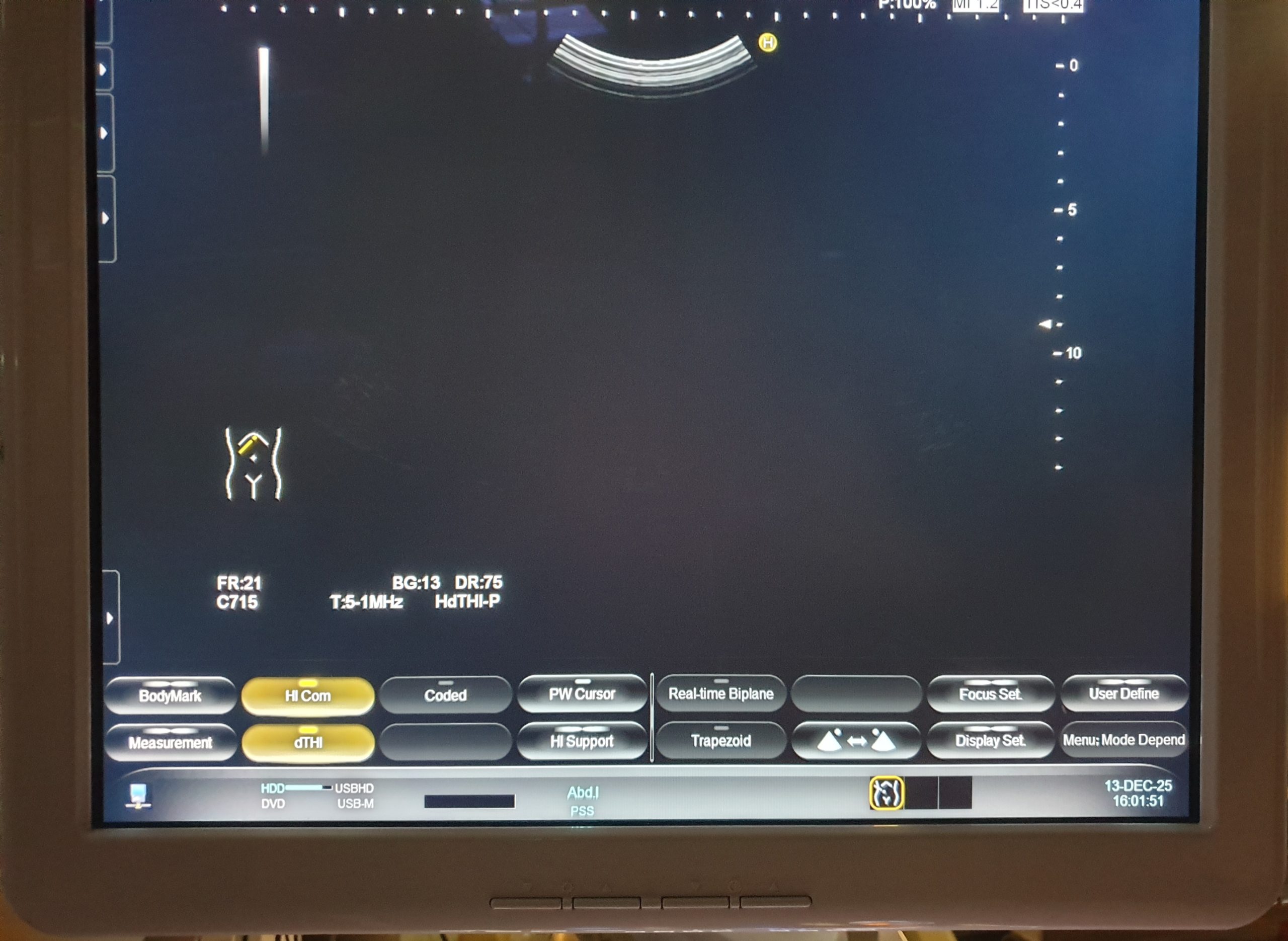 Hitachi EUP-C715 EUPC715 Ultraschall Konvexsonde – Bild 9