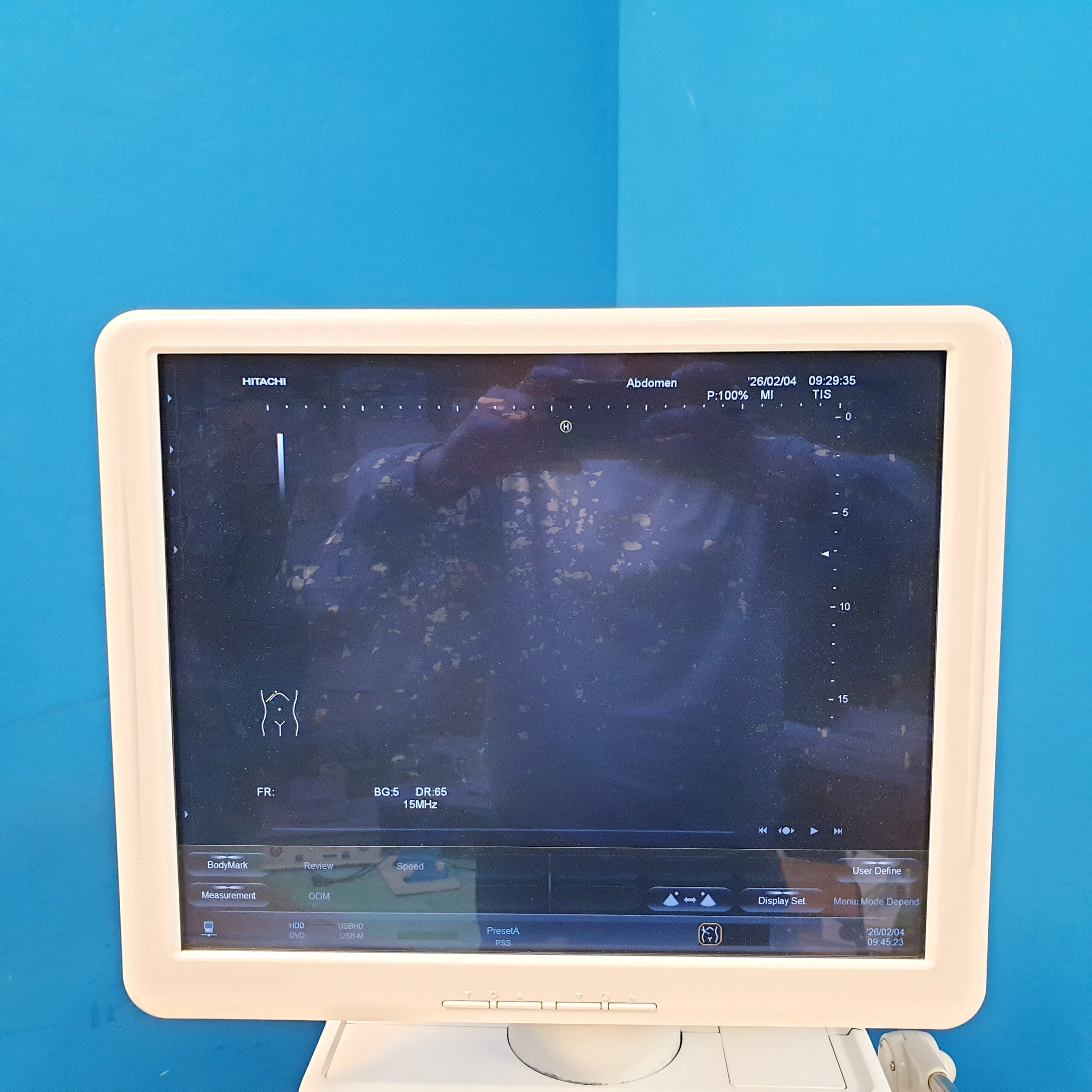 Hitachi Preirus - Ultraschallgerät - Defekt – Bild 10