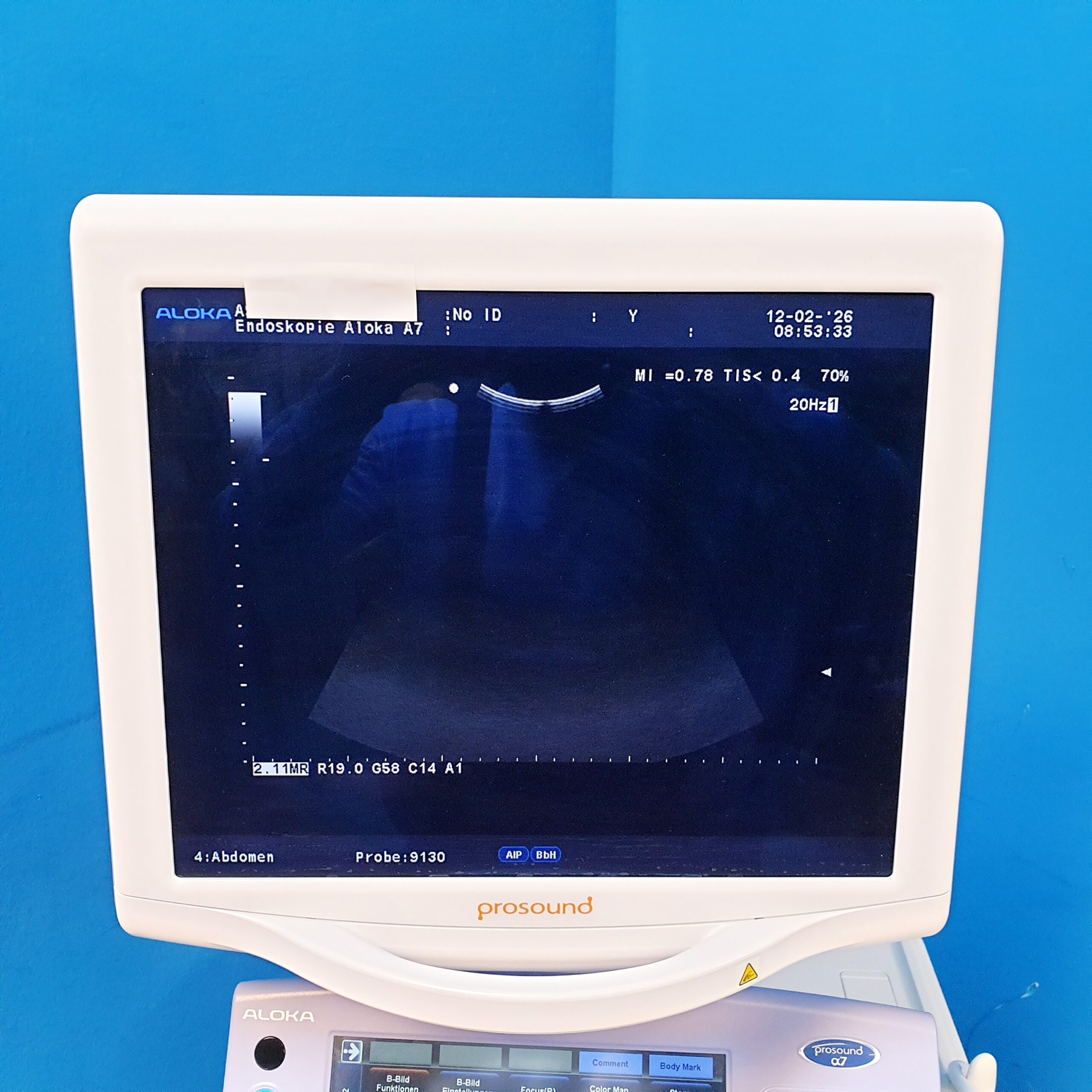 Aloka UST-9130 Ultraschallsonde – Bild 12