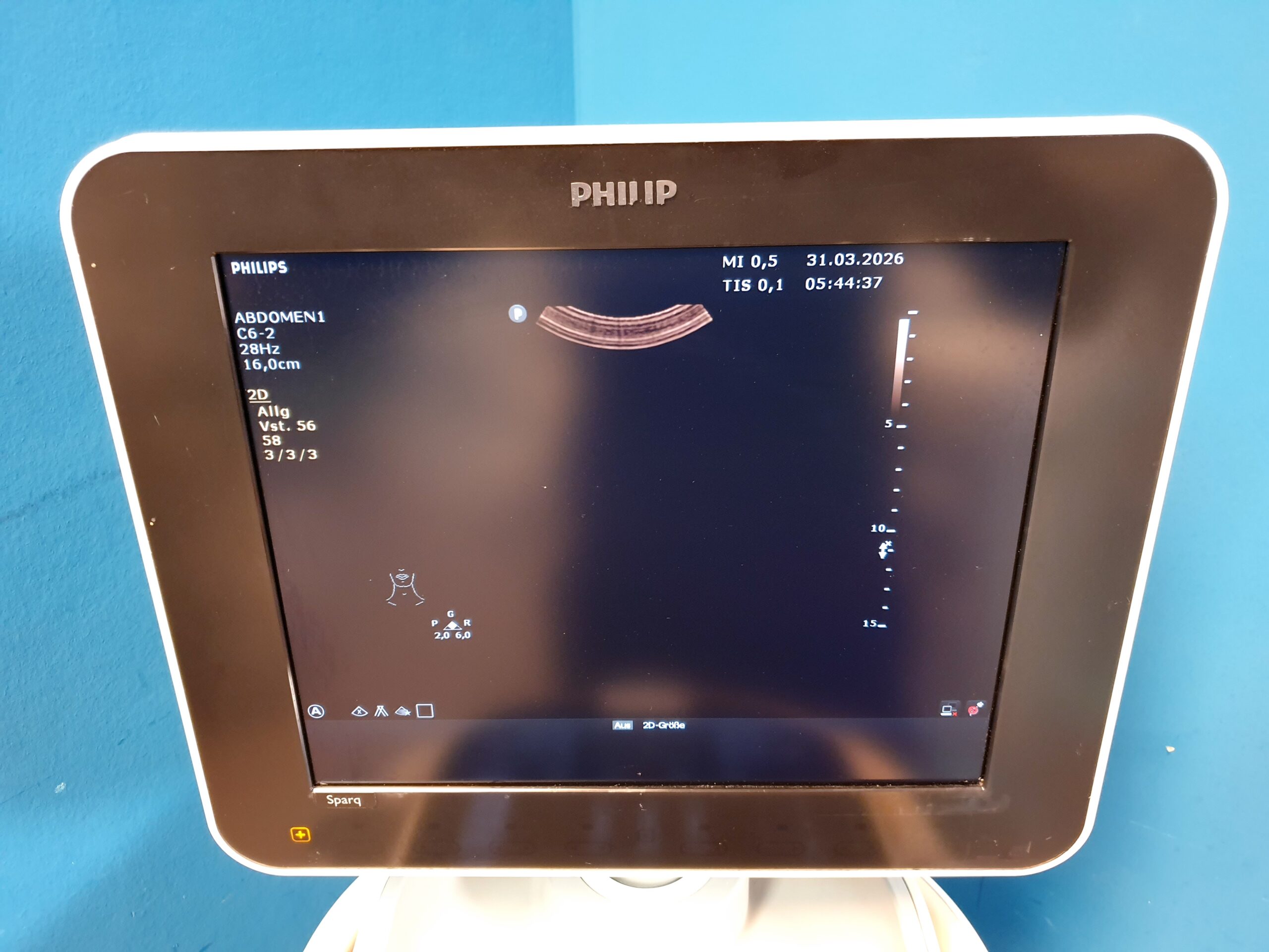 Philips Sparq C6-2 CW- Farbdoppler – Bild 15