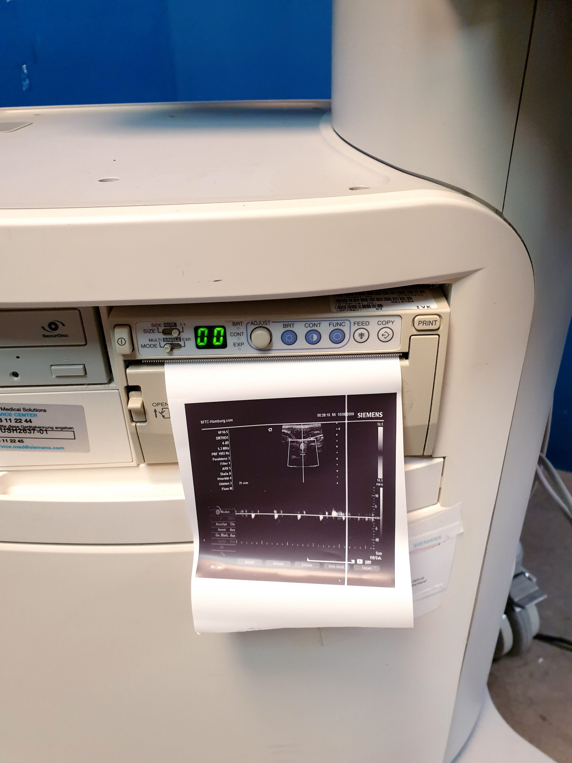 Siemens X150 X 150 + CH5-2 Konvex + VF10-5 Linearsonde – Bild 11