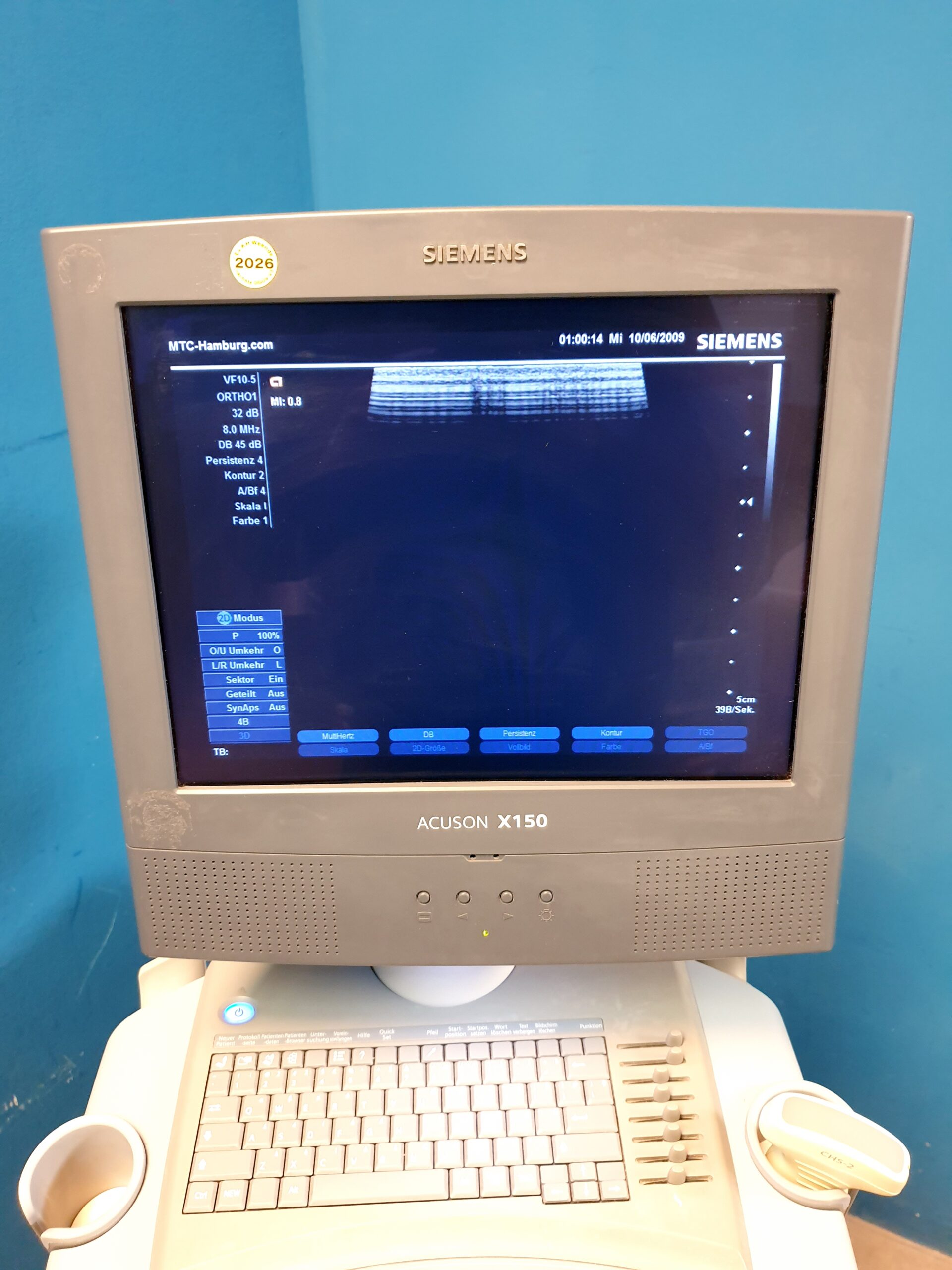 Siemens X150 X 150 + CH5-2 Konvex + VF10-5 Linearsonde – Bild 16