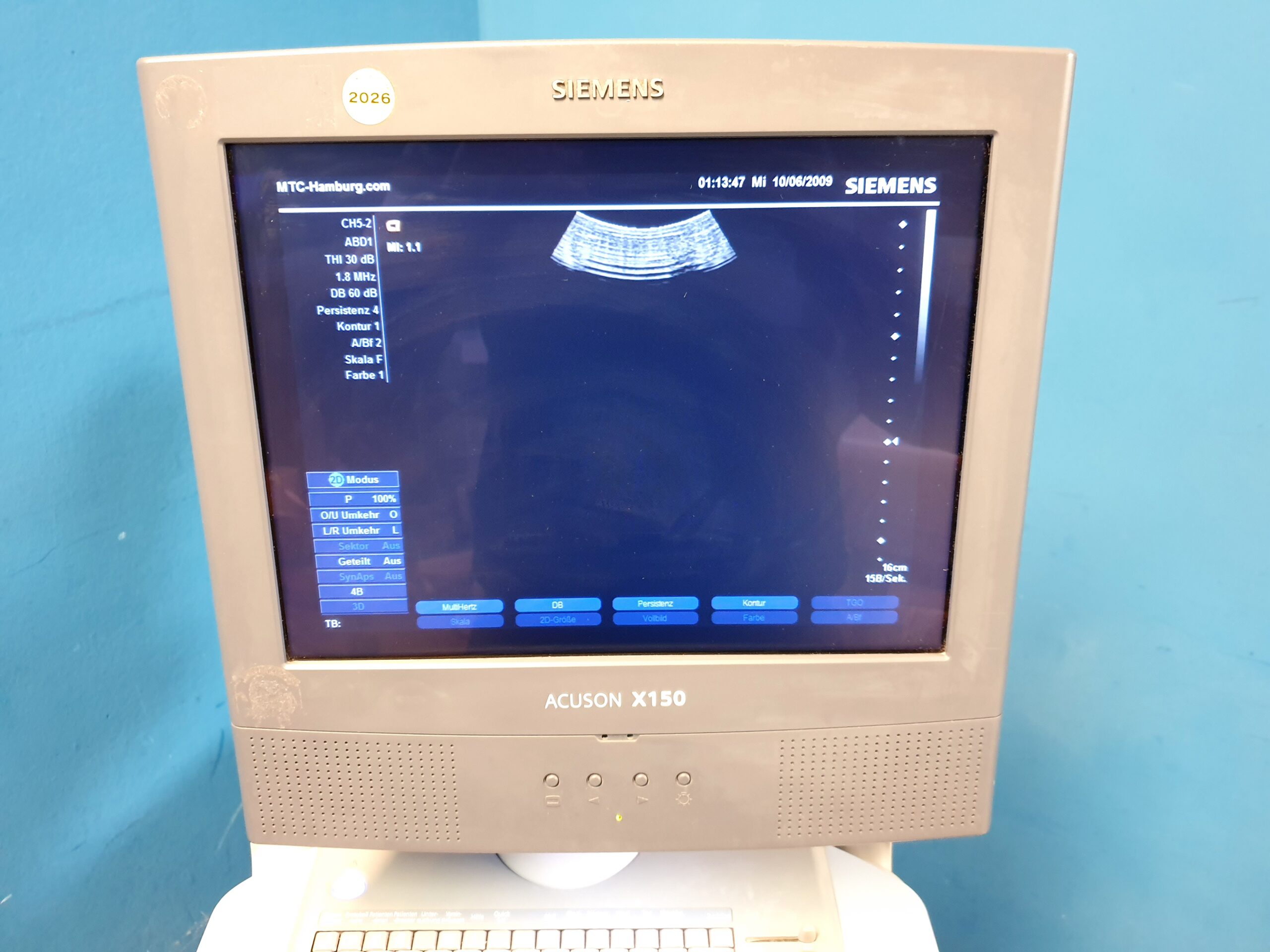 Siemens X150 X 150 + CH5-2 Konvex + VF10-5 Linearsonde – Bild 18