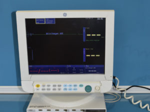 Datex Ohmeda S5 S/5 Patientenmonitor Überwachungsmonitor mit N-ESTPR Modul, Kabeln und Sensoren