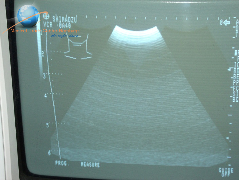 SHIMADZU VA40R-035U-4 Konvex Sonde 3.5Mhz